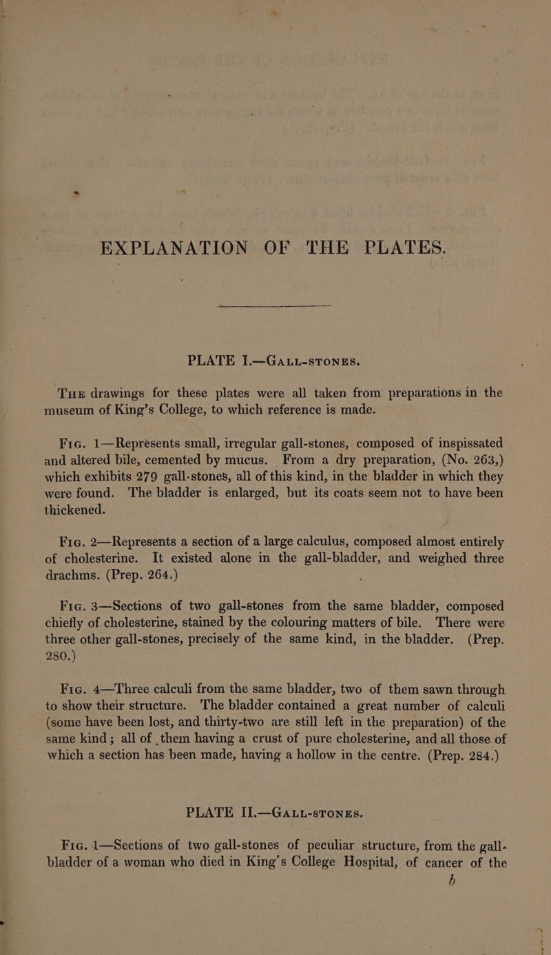 EXPLANATION OF THE PLATES. PLATE I.—GaALL-stTonEs. Tue drawings for these plates were all taken from preparations in the museum of King’s College, to which reference is made. Fic. 1—Represents small, irregular gall-stones, composed of inspissated and altered bile, cemented by mucus. From a dry preparation, (No. 263,) which exhibits 279 gall-stones, all of this kind, in the bladder in which they were found. The bladder is enlarged, but its coats seem not to have been thickened. Fic. 2—Represents a section of a large calculus, composed almost entirely of cholesterine. It existed alone in the gall-bladder, and weighed three drachms. (Prep. 264.) Fic. 3—Sections of two gall-stones from the same bladder, composed chiefly of cholesterine, stained by the colouring matters of bile. There were three other gall-stones, precisely of the same kind, in the bladder. (Prep. 280.) Fic. 4—Three calculi from the same bladder, two of them sawn through to show their structure. The bladder contained a great number of calculi (some have been lost, and thirty-two are still left in the preparation) of the same kind; all of them having a crust of pure cholesterine, and all those of which a section has been made, having a hollow in the centre. (Prep. 284.) PLATE II.—Ga.Lt-stTongs. Fic. 1—Sections of two gall-stones of peculiar structure, from the gall- bladder of a woman who died in King’s College Hospital, of cancer of the b sign Am