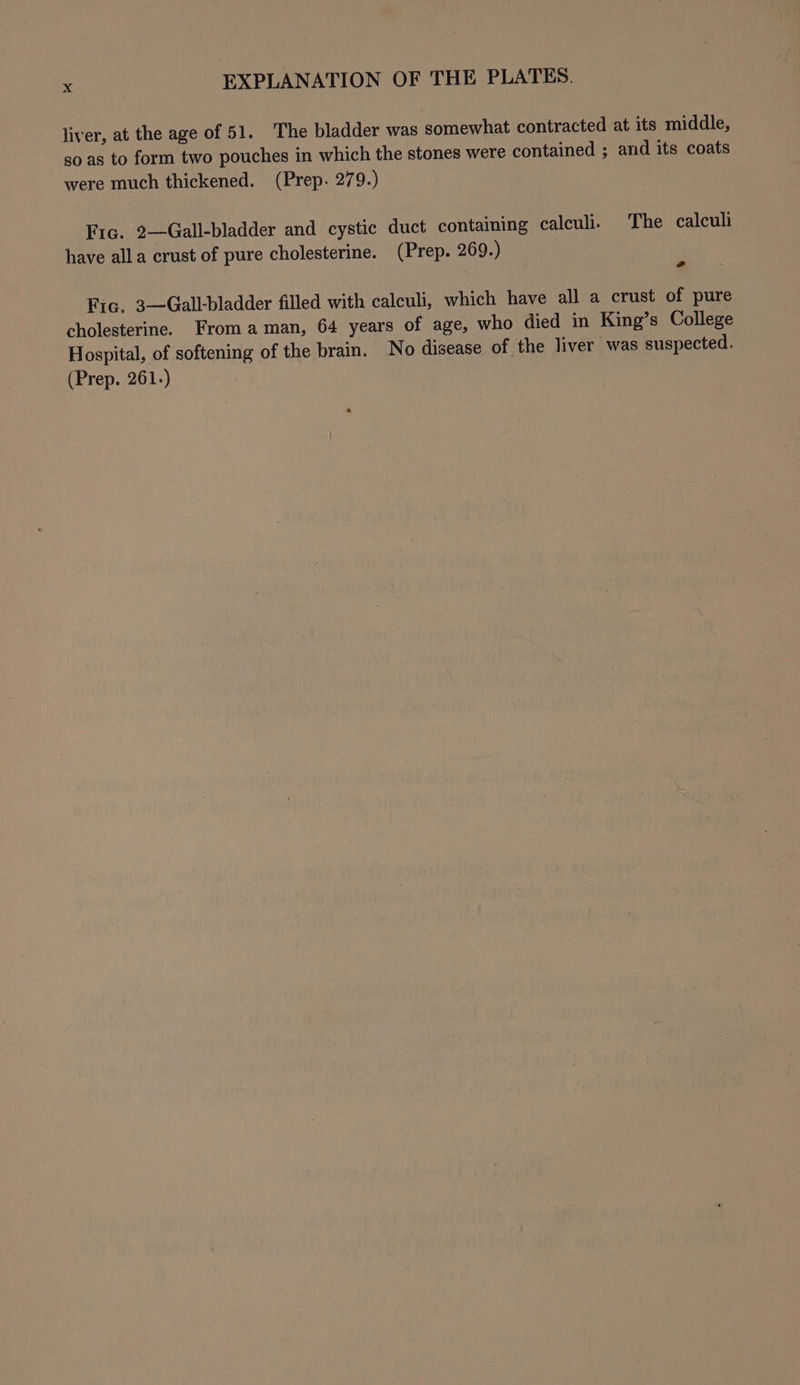 liver, at the age of 51. The bladder was somewhat contracted at its middle, so as to form two pouches in which the stones were contained ; and its coats were much thickened. (Prep. 279.) Fic. 2—Gall-bladder and cystic duct containing calculi. The calculi have alla crust of pure cholesterine. (Prep. 269.) Fic. 3—Gall-bladder filled with calculi, which have all a crust of pure cholesterine. From aman, 64 years of age, who died in King’s College Hospital, of softening of the brain. No disease of the liver was suspected. (Prep. 261.)