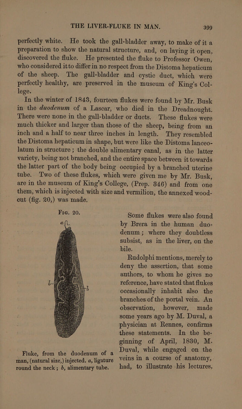 perfectly white. He took the gall-bladder away, to make of it a preparation to show the natural structure, and, on laying it open, discovered the fluke. He presented the fluke to Professor Owen, who considered itto differ in no respect from the Distoma hepaticum of the sheep. The gall-bladder and cystic duct, which were perfectly healthy, are preserved in the museum of King’s Ool- lege. In the winter of 1848, fourteen flukes were found by Mr. Busk in the duodenum of a Lascar, who died in the Dreadnought. There were none in the gall-bladder or ducts. These flukes were much thicker and larger than those of the sheep, being from an inch and a half to near three inches in length. They resembled the Distoma hepaticum in shape, but were like the Distoma lanceo- latum in structure ; the double alimentary canal, ag in the latter variety, being not branched, and the entire space between it towards the latter part of the body being occupied by a branched uterine tube. ‘Two of these flukes, which were given me by Mr. Busk, are in the museum of King’s College, (Prep. 846) and from one them, which is injected with size and vermilion, the annexed wood- cut (fig. 20,) was made. Some flukes were also found by Brera in the human duo- denum ; where they doubtless subsist, as in the liver, on the bile. Rudolphi mentions, merely to deny the assertion, that some authors, to whom he gives no reference, have stated that flukes occasionally inhabit also the branches of the portal vein. An observation, however, made some years ago by M. Duval, a physician at Rennes, confirms these statements. In the be- ginning of April, 1830, M. Fluke, from the duodenum of a Duval, while engaged jon:ithe man, (natural size,) injected. a, ligature veins 1n B eis? of anatomy, round the neck; 8, alimentary tube. had, to illustrate his lectures,