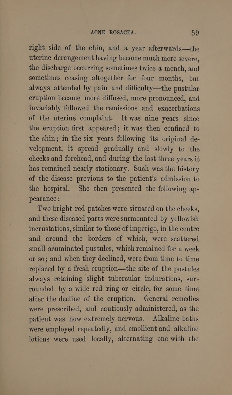 right side of the chin, and a year afterwards—the uterine derangement having become much more severe, the discharge occurring sometimes twice a month, and sometimes ceasing altogether for four months, but always attended by pain and difficulty—the pustular eruption became more diffused, more pronounced, and invariably followed the remissions and exacerbations of the uterine complaint. It was nine years since the eruption first appeared; it was then confined to the chin; in the six years following its original de- velopment, it spread gradually and slowly to the cheeks and forehead, and during the last three years it has remained nearly stationary. Such was the history of the disease previous to the patient’s admission to the hospital. She then presented the following ap- pearance: Two bright red patches were situated on the cheeks, and these diseased parts were surmounted by yellowish incrustations, similar to those of impetigo, in the centre and around the borders of which, were scattered small acuminated pustules, which remained for a week or so; and when they declined, were from time to time replaced by a fresh eruption—the site of the pustules always retaining slight tubercular indurations, sur- rounded by a wide red ring or circle, for some time after the decline of the eruption. General remedies were prescribed, and cautiously administered, as the patient was now extremely nervous. Alkaline baths were employed repeatedly, and emollient and alkaline lotions were used locally, alternating one with the