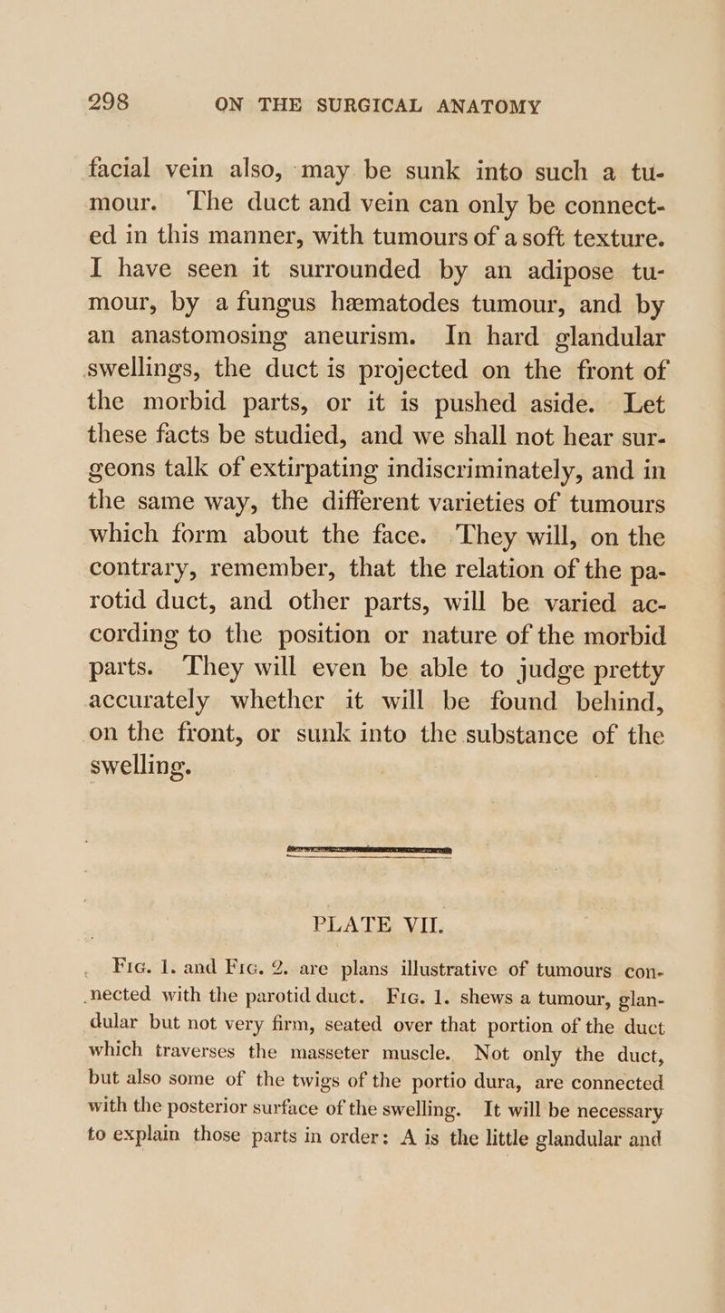 facial vein also, may be sunk into such a tu- mour. The duct and vein can only be connect- ed in this manner, with tumours of a soft texture. I have seen it surrounded by an adipose tu- mour, by a fungus hematodes tumour, and by an anastomosing aneurism. In hard glandular swellings, the duct is projected on the front of the morbid parts, or it is pushed aside. Let these facts be studied, and we shall not hear sur- geons talk of extirpating indiscriminately, and in the same way, the different varieties of tumours which form about the face. They will, on the contrary, remember, that the relation of the pa- rotid duct, and other parts, will be varied ac- cording to the position or nature of the morbid parts. ‘They will even be able to judge pretty accurately whether it will be found behind, on the front, or sunk into the substance of the swelling. PLATE VIL. Fic. 1. and Fre. 2. are plans illustrative of tumours con- nected with the parotid duct. Fic. 1. shews a tumour, glan- dular but not very firm, seated over that portion of the duct which traverses the masseter muscle. Not only the duct, but also some of the twigs of the portio dura, are connected with the posterior surface of the swelling. It will be necessary to explain those parts in order: A is the little glandular and
