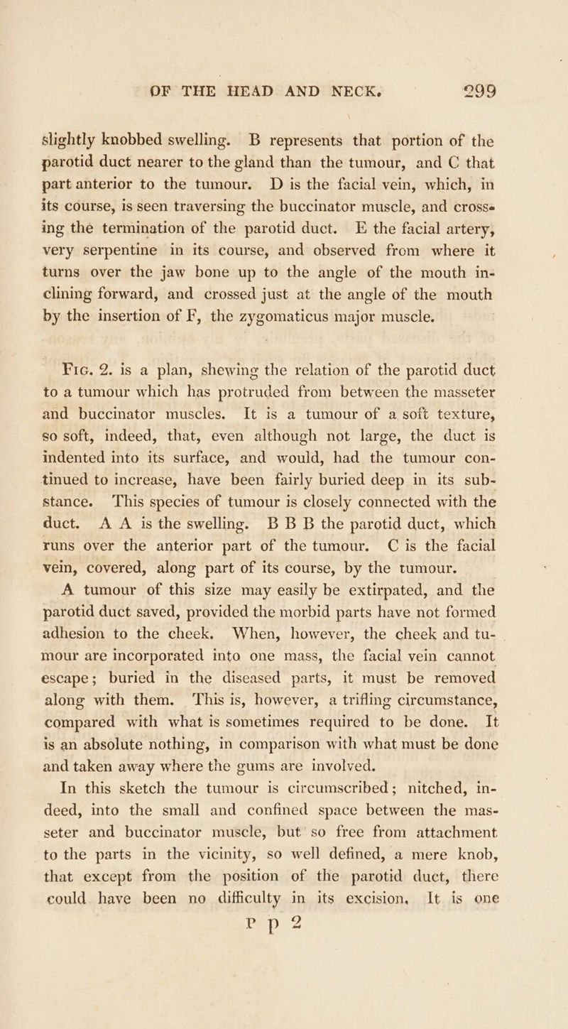 slightly knobbed swelling. B represents that portion of the parotid duct nearer to the gland than the tumour, and C that part anterior to the tumour. D is the facial vein, which, in its course, is seen traversing the buccinator muscle, and cross« ing the termination of the parotid duct. E the facial artery, very serpentine in its course, and observed from where it turns over the jaw bone up to the angle of the mouth in- clining forward, and crossed just at the angle of the mouth by the insertion of F, the zygomaticus major muscle. Fic. 2. is a plan, shewing the relation of the parotid duct to a tumour which has protruded from between the masseter and buccinator muscles. It is a tumour of a soft texture, so soft, indeed, that, even although not large, the duct is indented into its surface, and would, had the tumour con- tinued to increase, have been fairly buried deep in its sub- stance. ‘This species of tumour is closely connected with the duct. A A is the swelling. BB B the parotid duct, which runs over the anterior part of the tumour. C is the facial vein, covered, along part of its course, by the tumour. A tumour of this size may easily be extirpated, and the parotid duct saved, provided the morbid parts have not formed adhesion to the cheek. When, however, the cheek and tu- mour are incorporated into one mass, the facial vein cannot escape; buried in the diseased parts, it must be removed along with them. ‘This is, however, a trifling circumstance, compared with what is sometimes required to be done. It is an absolute nothing, in comparison with what must be done and taken away where the gums are involved. In this sketch the tumour is circumscribed; nitched, in- deed, into the small and confined space between the mas- seter and buccinator muscle, but so free from attachment to the parts in the vicinity, so well defined, a mere knob, that except from the position of the parotid duct, there could have been no difficulty in its excision, It is one eee
