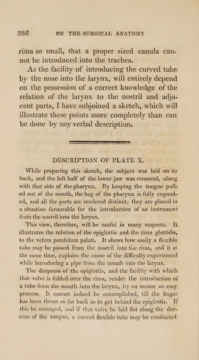 rima so small, that a proper sized canula can- not be introduced into the trachea. As the facility of introducing the curved tube ‘by the nose into the larynx, will entirely depend on the possession of a correct knowledge of the relation of the larynx to the nostril and adja- cent parts, I have subjoined a sketch, which will illustrate these points more completely than can be done by any verbal description. a DESCRIPTION OF PLATE X. While preparing this sketch, the subject was laid on its back, and the left half of the lower jaw was removed, along with that side of the pharynx. By keeping the tongue pull- ed out of the mouth, the bag of the pharynx is fully expand- ed, and all the parts are rendered distinct; they are placed in a situation favourable for the introduction of an instrument from the nostril into the larynx. This view, therefore, will be useful im many respects. It illustrates the relation of the epiglottis and the rima glottidis, to the velum pendulum palati. It shews how easily a flexible tube may be passed from the nostril into tie rima, and it at the same time, explains the cause of the difficulty experienced while mtroducing a pipe from the mouth into the larynx. The deepness of the epiglottis, and the facility with which that valve is folded over the rima, render the introduction of a tube from the mouth into the larynx, by no means an easy process, It cannot indeed be accomplished, till the finger has been thrust so far back as to get behind the epiglottis. If this be managed, and if that valve be laid flat along the dor- sum of the tongue, a curved flexible tube may be conducted