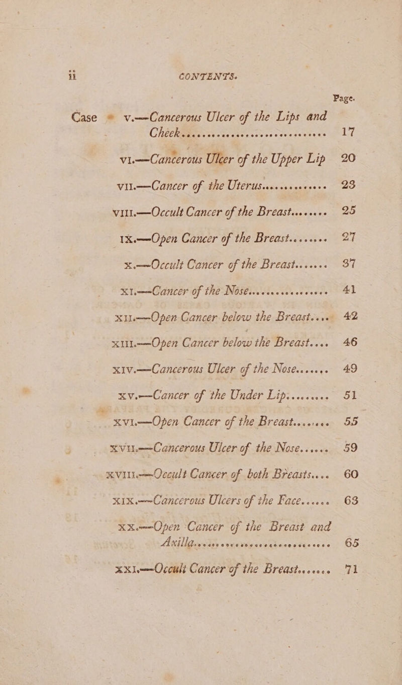 Page. Case © v.—-Cancerous Ulcer of the Lips and CHECKEIEES isa siesssscsscy-seededs 11 vi.—Canterous Ulcer of the Upper Lip 20 vil.—Cancer of the Uterusi.. pe Oy eae vili.—Occult Cancer of the Bredsticcsseee 25 (1X.—Open Cancer of the Bretstecc.e. 27 x.—~Occult Cancer of the Breast... 37 x1——Cancer of the Nostswccccccccorses AL x1L—Open Cancer below the Breast..... 42 xuL—Open Cancer below the Breast.... 46 xiv.—Cancerous Ulcer of the Noses. 49 xve—Cancer of the Under Lips... 51 6 xvi-—Open Cancer of the Breast... 55 | xvu.-—Cancerous Ulcer of the Nose...... 59 XVUL—Occult Cancer of both Breasts... 60 xIx——Cancerous Ulcers of the Facé...... 63 XXu—Open Cancer of the Breast and Ai lgnsRty svunvvigase eines sts sess 65 xxi—Occult Cancer of the Breastrccocs ‘71.