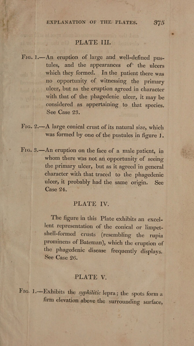 4 PLATE IL. Fic, 1.—An eruption of large and well-defined pus- tules, and the appearances of* the ulcers which they formed. Inthe patient there was no opportunity of witnessing the primary ulcer, but as the eruption agreed in character with that of the phagedenic ulcer, it may be considered as appertaining to that species. See Case 23. Tic. 2.—A large conical crust of its natural size, which was formed by one of the pustules in figure 1. Fic, 3.—An eruption on the face of a male patient, in whom there was not an opportunity of seeing the primary ulcer, but as it agreed in general character with that traced to the phagedenic Case 24: PLATE: IV. The figure in this Plate exhibits an excel- lent representation of the conical or limpet- shell-formed crusts (resembling the rupia prominens of Bateman), which the eruption of the phagedenic disease frequently ery See Case 26. PLATE V. Fic. 1.—Exhibits the syphilitic lepra ; the spots form a firm clevadiein above the surrounding surface,