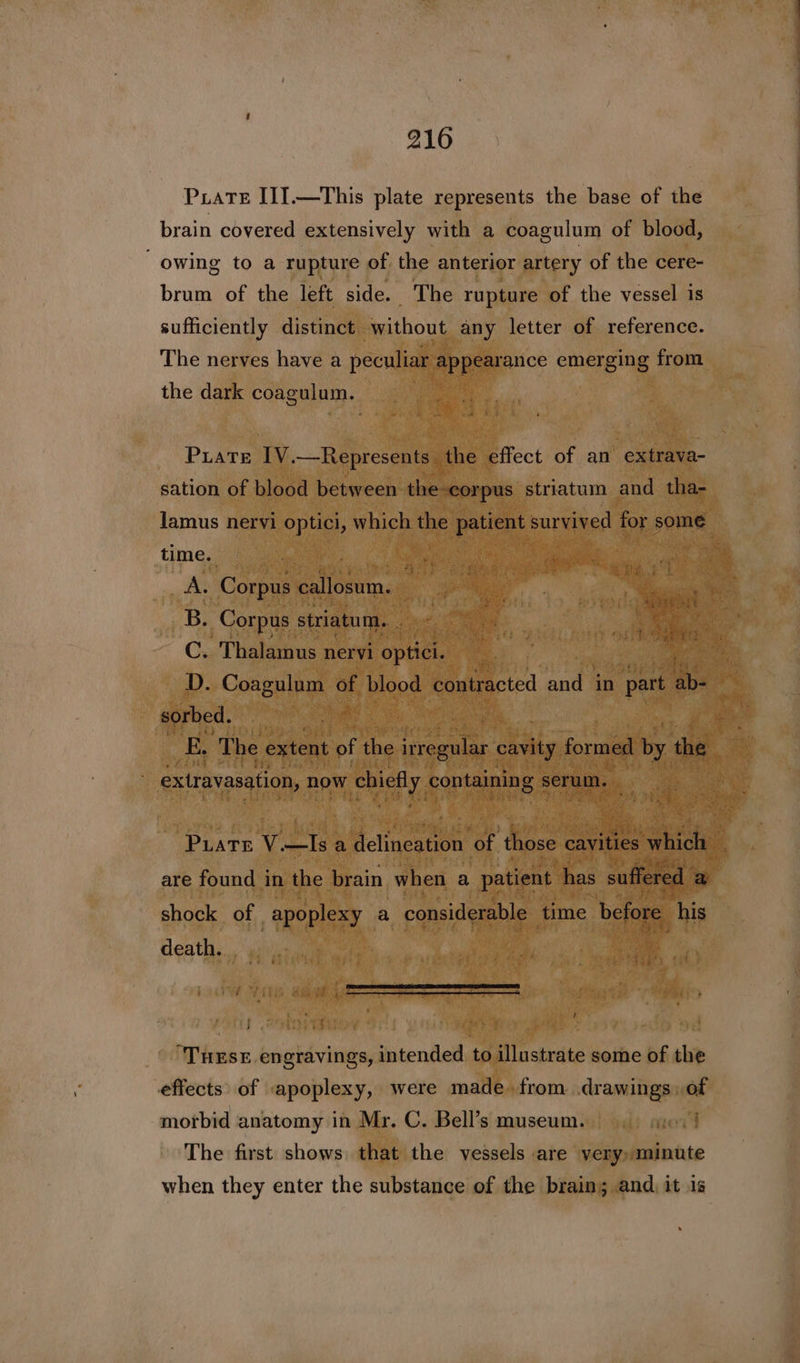 216 Puate I1I.—This plate represents the base of the brain covered extensively with a coagulum of blood, owing to a rupture of. the anterior artery of the cere- brum of the left side. The rupture of the vessel is sufficiently distinct without any letter of reference. The nerves have a peculiar appearance emerging from the dark coagulum. : Puate [V.—Represents the effect of an extrava- sation of blood between the-corpus striatum and tha- lamus nervi optici, which ne patient survived for some time. A. Corpus callosum. B. Corpus striatum. ya i ie bet yA C. Thalamus nervi optici. D. Coagulum of blood contracted and in part ay sorbed. | E, ‘The extent of the irregular cavity formed by the extravasation, now chiefly containing : serum. : Pure Ve iee flincoeon ‘of those cavities sithfels” are found in the brain when a patient has suffered a shock of apoplexy a considerable time before his death. - P t ; “THESE. engravings, intended to illustrate some of the effects’ of apoplexy, were made. from drawings: od morbid anatomy in Mr. C. Bell’s museum. : The first shows that the vessels are very, minute when they enter the substance of the brain; and, it is