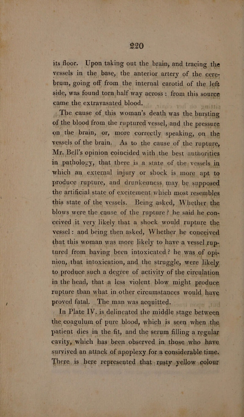 its oor. Upon taking out the brain, and tracing the vessels in the base, the anterior artery of the cere- brum, going off from the internal carotid of the left side, was found torn. half Way across: from this source came the extrayasated blood, ein The cause of this woman’s death was the bnieie of the blood from the ruptured vessel, and the pressure on the brain, or, more correctly speaking, on. the vessels of the brain. As to the cause of the rupture, Mr, Bell’s opinion coincided with the best authorities in pathology, that there is a state of the, vessels in which an external injury or shock is more apt to— produce rupture, and drunkenness. may. be supposed the artificial state of excitement which most resembles this state of the vessels. Being asked, Whether, the blows were the cause of the rupture? he said he con- ceived it very likely that a shock would rupture the vessel: and being then asked, Whether he conceived that this woman was more likely to have a vessel rup- tured from having been intoxicated? he was of opi- nion, that intoxication, and the struggle, were likely. to produce such a degree of actiyity of the circulation in the head, that a less violent blow might produce rupture than what in other circumstances would, haye proved fatal. ‘The man was acquitted. i. In Plate IV. is delineated the middle stage between the coagulum of pure blood, which is seen when the patient dies in the fit, and the serum filling a regulary cavity, which has been observed in those who have suryiyved an attack of apoplexy for a considerable time. There is here represented that . rusty, yellow colour