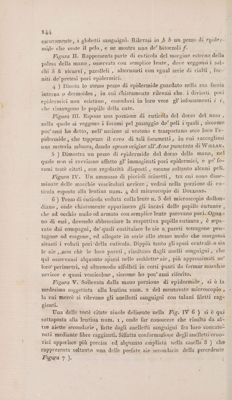 oscuramente, i globetti sanguigni. Rilevasi in 3 è un pezzo di epider- migde che veste il pelo, e ne mostra uno de’ bitorzoli f. Figura Il. Rappresenta parte di cuticola del margine esterno della palma della mano , osservata con semplice lente, dove veggonsii sol- chi 4 &amp; ricurvi, paralleli, alternanti con egual serie di rialti , for- niti de’pretesi pori epidermici. 4 ) Dinota lo stesso pezzo di epidermide guardato nella sua faccia interna o dermoidea; in cuni chiaramente rilevasi che, i divisati pori epidermici non esistàno , essendovi in loro vece gV infossamenti è #, che rimangono le papille della cute. Figura IN. Espone una porzione di cuticola del dorso del naso , nella quale si veggono i forami pel passaggio de’ peli i quali, siccome poc'anzi ho detto, nell’ uscirne si vestono e trasportano seco loro l’e- pidermide, che tappezza il cavo di tali forametti, in cui raccogliesi una meteria sebacea, dando spesso origine all’ Acne punctata di WiLLANn, 5 ) Dimostra un pezzo di epidermide del dorso della mano, nel quale non si ravvisano affatto gl’ immaginati pori epidermici, e pe’ fo- rami testè citati, con regolarità disposti , escono soltanto alcuni peli. Figura TV. Un ammasso di piccioli acinetti, tra cui sono disse- minate delle macchie vescitolari nericce , vedesi nella porzione di cu- ticola esposta alla lentina num. 4 del microscopio di DoLLonp. 6 ) Pezzo di cuticola veduta colla lentéè n. 3 del microscopio dollon- diano, onde chiaramente apparissero gli incavi delle papille cutanee , che ad occhio nudo od armato con semplice lente parevano pori..Ognn- no di essi, dovendo abbracciare la respettiva papilla cutanea , è scpa- rato dai compagni, de’ quali costituisce le aie a, pareti tetragone pen- tagone od esagone, ed allogate in serie allo stesso modo che scorgonsi situati i voluti pori‘della cuticola. Dippiù tanto gli spazi centrali.o sia le aie mon chè le loro pareti, risultano dagli anelli sanguigni, che quì osservansi alquanto sparsi nelle suddette” aie, più approssimati ne” loro* perimetri, ed oltremodo affollati in certi punti da formar maechie nericce e quasi vescicolose , siccome ho poc’ anzi riferito. Figura V. Sollevata dalla mano porzione di epidermide , si è la medesima soggettata alla lentina num. 2 del mentovato microscopio » la cui mercè si rilevano gli anelletti sanguigni con taluni filetti rag- gianti. ; Una delle testè citate aiuole delineate nella Fig. IV 6 ) si è qui sottoposta alla lentina num. 1, onde far conoscere che risulta da al- tre aiette secondarie , fatte dagli anelletti sanguigni fra loro concate- nati mediante fibre raggianti. Siffatta conformazione degli anelletti cruo- rici apparisce più precisa ed alqhanto ampliata nella casella 8 ) che rappresenta soltanto una delle prefate aie secondarie della precedente Figura 7 ).