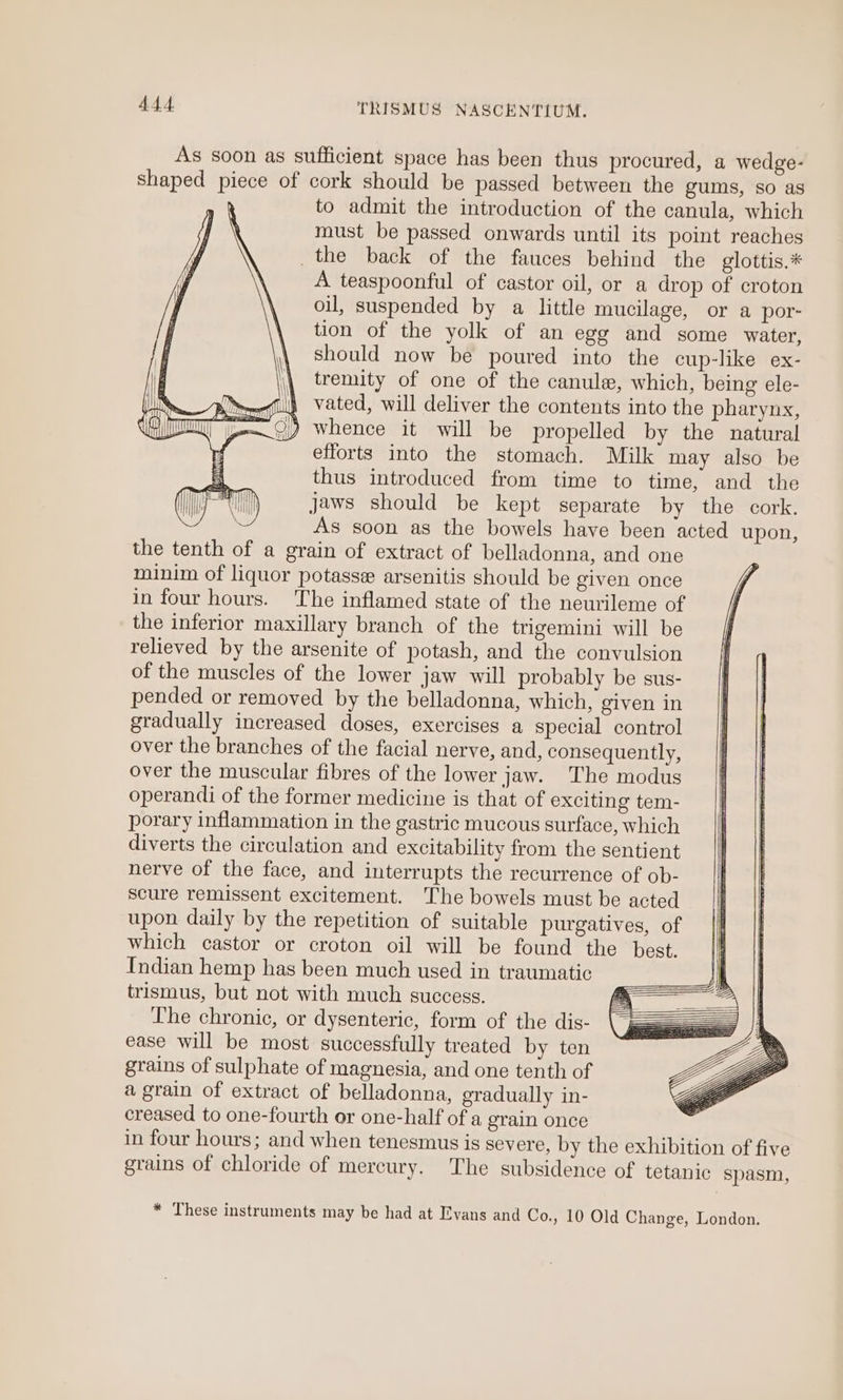 As soon as sufficient space has been thus procured, a wedge- shaped piece of cork should be passed between the gums, SO as to admit the introduction of the canula, which must be passed onwards until its point reaches the back of the fauces behind the glottis.* A teaspoonful of castor oil, or a drop of croton oil, suspended by a little mucilage, or a por- tion of the yolk of an egg and some water, should now be poured into the cup-like ex- \\ tremity of one of the canule, which, being ele- i} vated, will deliver the contents into the pharynx, Q) whence it will be propelled by the natural efforts into the stomach. Milk may also be thus introduced from time to time, and the jaws should be kept separate by the cork. As soon as the bowels have been acted upon, the tenth of a grain of extract of belladonna, and one minim of liquor potasse arsenitis should be given once in four hours. ‘The inflamed state of the neurileme of the inferior maxillary branch of the trigemini will be relieved by the arsenite of potash, and the convulsion of the muscles of the lower jaw will probably be sus- pended or removed by the belladonna, which, given in gradually increased doses, exercises a special control over the branches of the facial nerve, and, consequently, over the muscular fibres of the lower jaw. The modus operandi of the former medicine is that of exciting tem- porary inflammation in the gastric mucous surface, which diverts the circulation and excitability from the sentient nerve of the face, and interrupts the recurrence of ob- scure remissent excitement. The bowels must be acted upon daily by the repetition of suitable purgatives, of which castor or croton oil will be found the best. Indian hemp has been much used in traumatic trismus, but not with much success. Faiecee The chronic, or dysenteric, form of the dis- p= _ZZ™ ease will be most successfully treated by ten ax\ grains of sulphate of magnesia, and one tenth of BL a a grain of extract of belladonna, gradually in- Yo creased to one-fourth or one-half of a grain once in four hours; and when tenesmus is severe, by the exhibition of five grains of chloride of mercury. The subsidence of tetanic spasm, * These instruments may be had at Evans and Co., 10 Old Change, London.