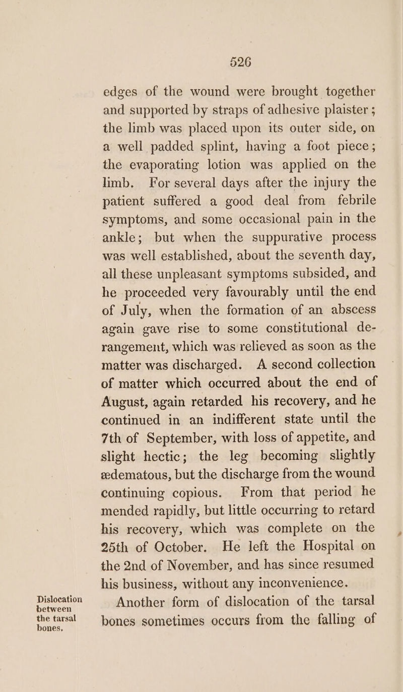 Dislocation between the tarsal bones, 526 edges of the wound were brought together and supported by straps of adhesive plaister ; the limb was placed upon its outer side, on a well padded splint, having a foot piece; the evaporating lotion was applied on the limb. For several days after the injury the patient suffered a good deal from febrile symptoms, and some occasional pain in the ankle; but when the suppurative process was well established, about the seventh day, all these unpleasant symptoms subsided, and he proceeded very favourably until the end of July, when the formation of an abscess again gave rise to some constitutional de- rangement, which was relieved as soon as the matter was discharged. A second collection of matter which occurred about the end of August, again retarded his recovery, and he continued in an indifferent state until the 7th of September, with loss of appetite, and slight hectic; the leg becoming slightly edematous, but the discharge from the wound continuing copious. From that period he mended rapidly, but little occurring to retard his recovery, which was complete on the 25th of October. He left the Hospital on the 2nd of November, and has since resumed his business, without any inconvenience. Another form of dislocation of the tarsal bones sometimes occurs from the falling of