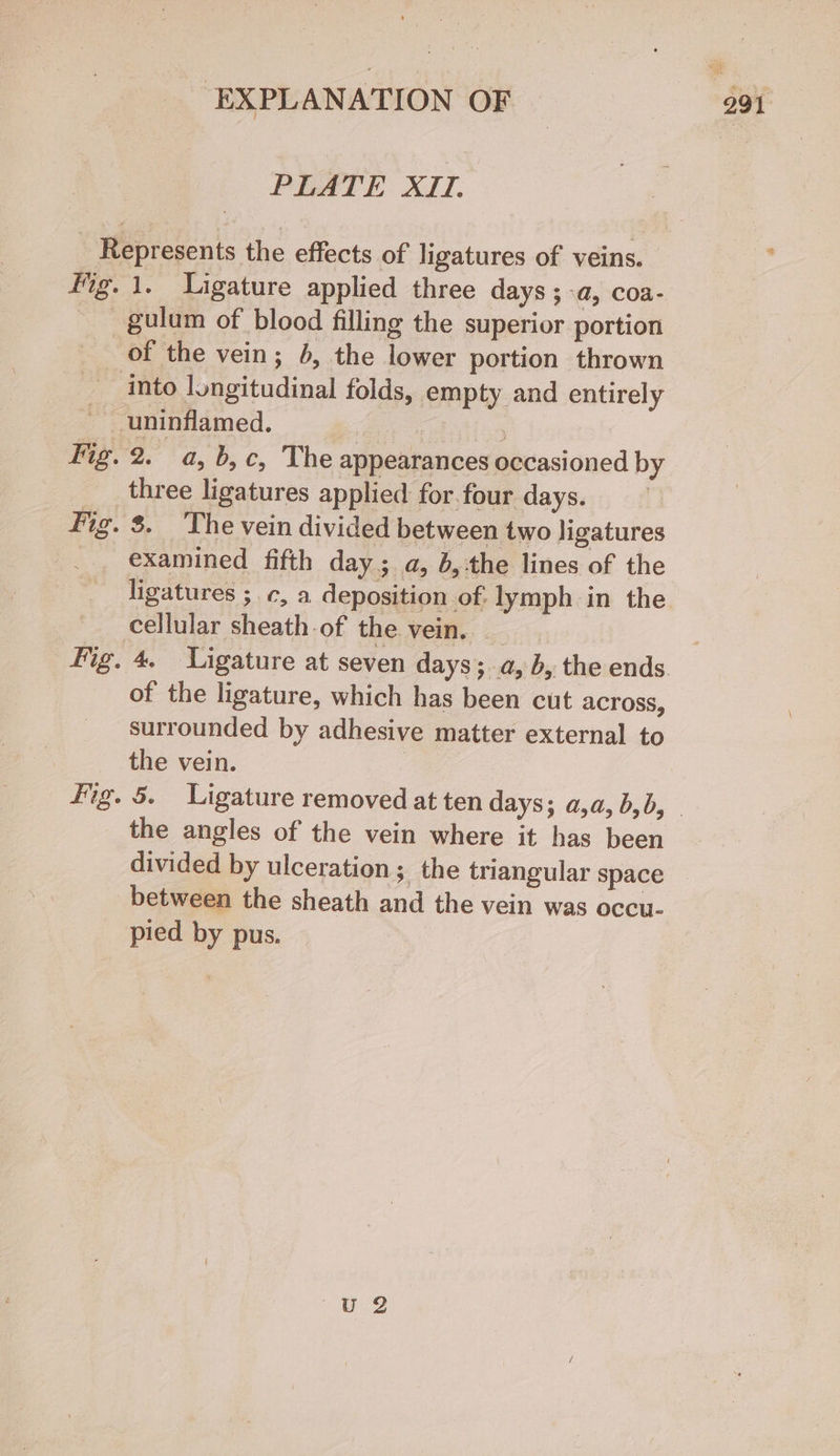 PLATE XII. 1. Ligature applied three days ; a, COa- of the vein; 6, the lower portion thrown 2. a, b,c, The appearances occasioned b three ligatures applied for.four days. : 8. The vein divided between two ligatures examined fifth day; a, b,-the lines of the ligatures ;.c, a deposition of: lymph in the cellular sheath-of the vein. surrounded by adhesive matter external to the vein. | the angles of the vein where it has been between the sheath and the vein was occu- pied by pus.