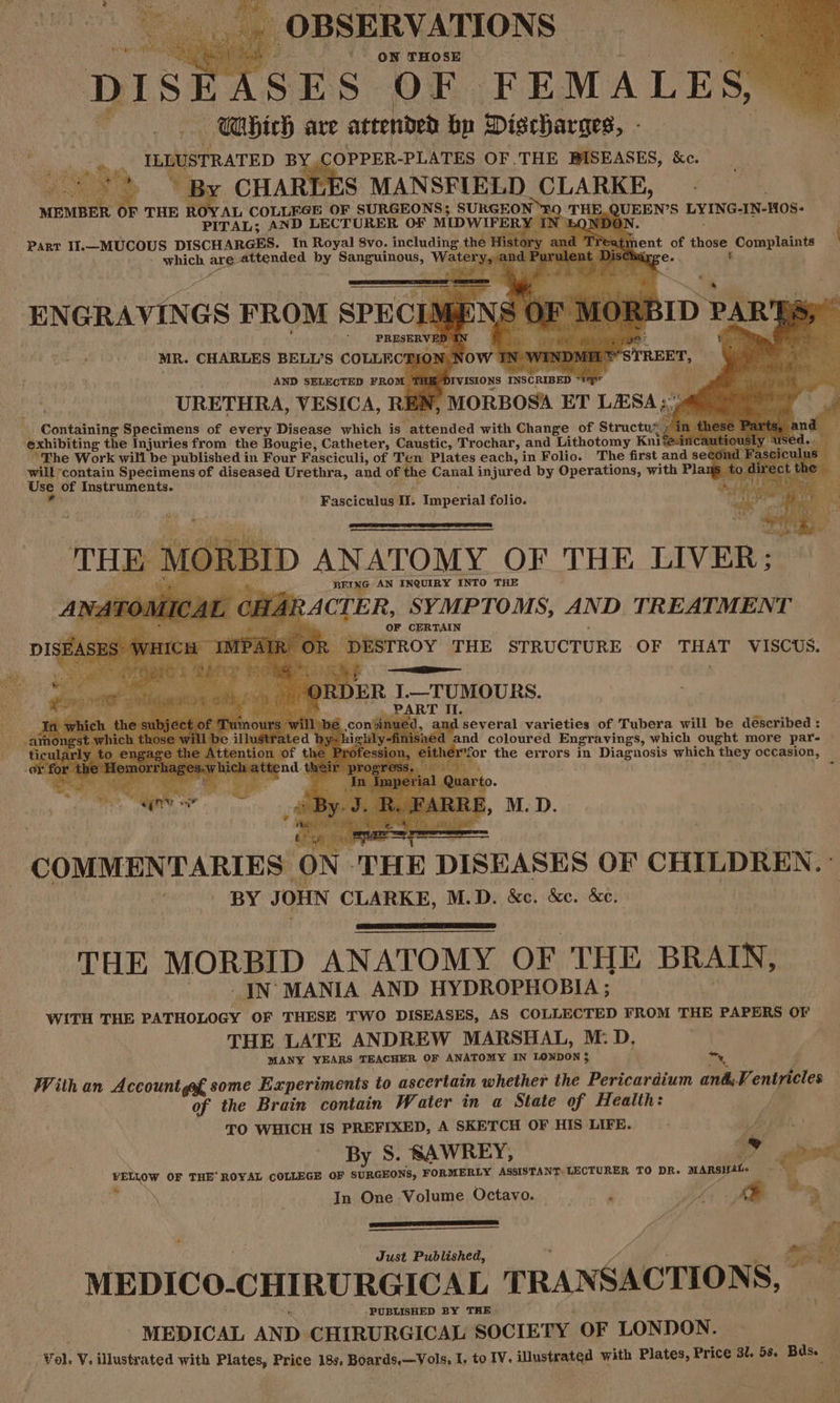 _. OBSERVATIONS a in . ‘* on THOSE a SES ike FEMALE ) — Mbich are attended hp Discharges, - wae? v +4 ILLUSTRATED B OPPER-PLATES OF THE BISEASES, &e. : oon” \ By CHARLES MANSFIELD CLARKE, : F THE | JY AL COLLEGE OF SURGEONS; SURGEON ‘¥: Q pen LYING-IN-HOS- TAL; AND LECTURER OF MIDWIFE . | 2 the | Part I1.—MUCOUS neuaee In Royal 8vo. includin nt of iioee Complaints - svhich Das attended by Saneqinene, Ww. re t MR. CHARLES BELLS COLLECT! : AND SELECTED FROM URETHRA, VESICA, RE Containing Specimens of every Disease which is “attended with Change of Structuy exhibiting the Injuries from the Bougie, Catheter, Caustic, Trochar, and Lithotomy Knife : Fhe Work will be published in Four Fasciculi, of Ten Plates each, in Folio. The first and se will ‘contain Specimens of diseased Urethra, and of the Canal injured by Operations, with Pla Use of Instruments. Fasciculus I. Imperial folio. 5 REV G AN INQUIRY INTO THE 2 ACTER, SYMPTOMS, AND TREATMENT OF CERTAIN R DESTROY THE STRUCTURE OF THAT VISCUS. DER I.—TUMOURS. PART II. and several varieties of Tubera will be described : ed and coloured Engravings, which ought more pare ~ 7, the evrors in iis tess which they occasion, COMMENTARIES: ‘ON. THE DISEASES OF CHILDREN. : ' BY JOHN CLARKE, M.D. &c. &e. &. THE MORBID ANATOMY OF THE BRAIN, JN’ MANIA AND HYDROPHOBIA ; , WITH THE PATHOLOGY OF THESE TWO DISEASES, AS COLLECTED FROM THE PAPERS OF THE LATE ANDREW MARSHAL, M: D MANY YEARS TEACHER OF ANATOMY IN LONDON 3 With an Account gf some Experiments to ascertain whether the Pericardium ant Yentrieles of the Brain contain Water in a State of Health: y ~ TO WHICH IS PREFIXED, A SKETCH OF HIS LIFE. Wy By S. SAWREY, a FELLOW OF THE’ ROYAL COLLEGE OF SURGEONS, FORMERLY ASSISTANT, LECTURER TO DR. MARSHAL es i \ . In One Volume Octavo. 4 m, Auer re) iy * Just Published, MEDICO.CHIRURGICAL TRANSACTIONS, — PUBLISHED BY THE MEDICAL AND. CHIRURGICAL SOCIETY OF LONDON. ‘ “4 Vol, V. illustrated with Plates, Price 18s, Boards.—Vols, I. to IV. Tarte with Plates, Price Bl. 58. Bds.