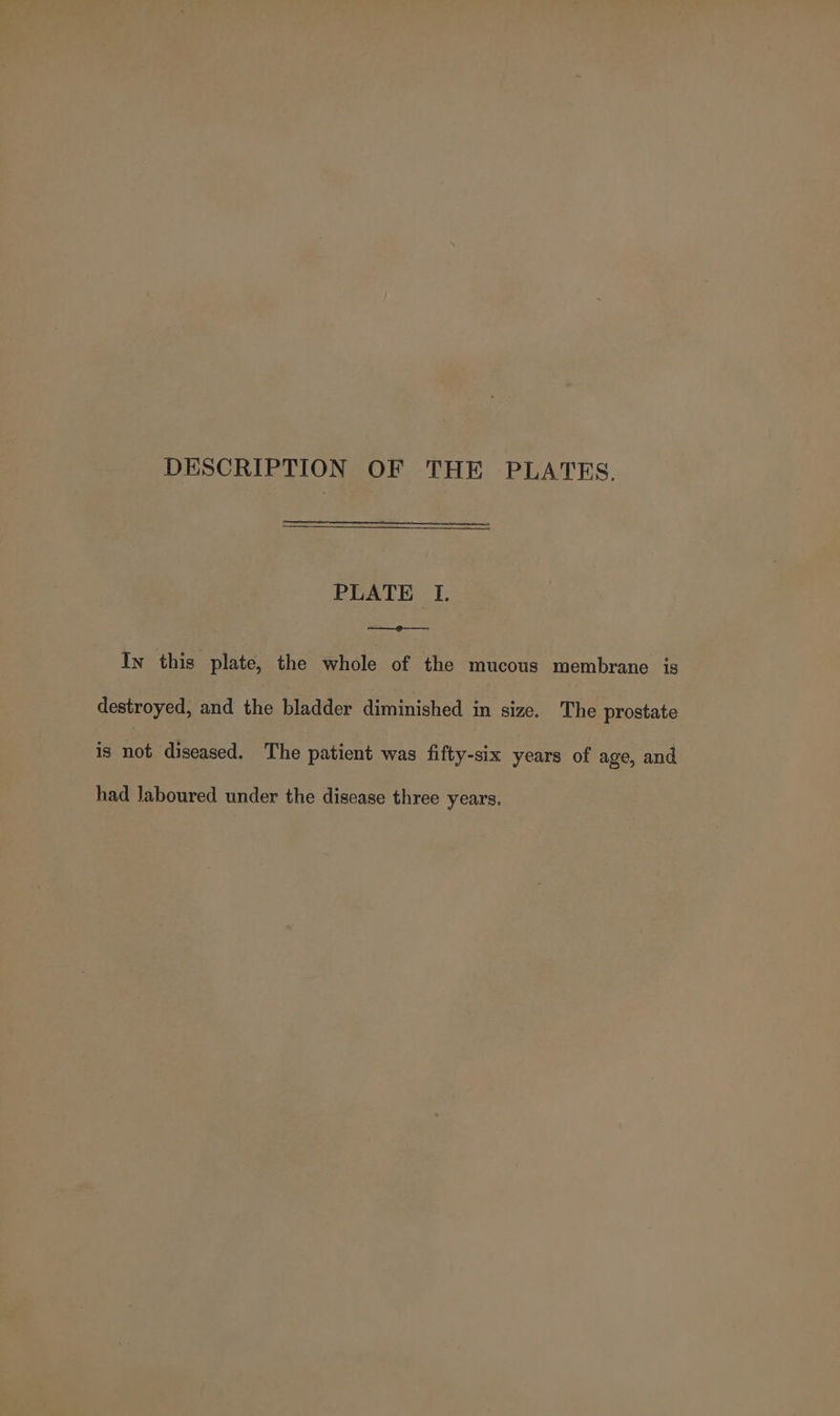 DESCRIPTION OF THE PLATES. PLATE I, ——_@-—_—. In this plate, the whole of the mucous membrane is destroyed, and the bladder diminished in size. The prostate is not diseased. The patient was fifty-six years of age, and had Jaboured under the disease three years.