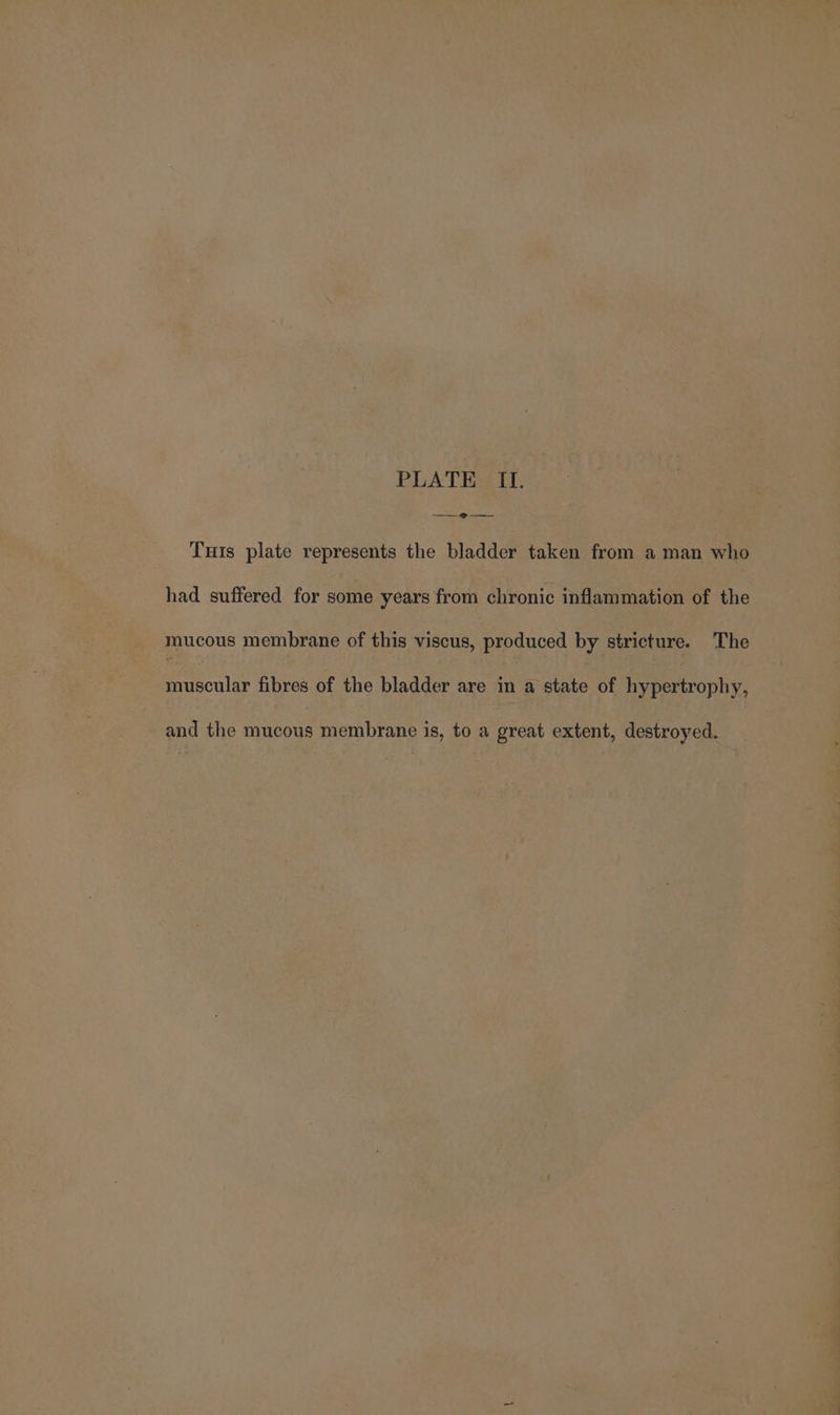 PLATE II. Tuts plate represents the bladder taken from a man who had suffered for some years from chronic inflammation of the mucous membrane of this viscus, produced by stricture. The muscular fibres of the bladder are in a state of hypertrophy, and the mucous membrane is, to a great extent, destroyed.