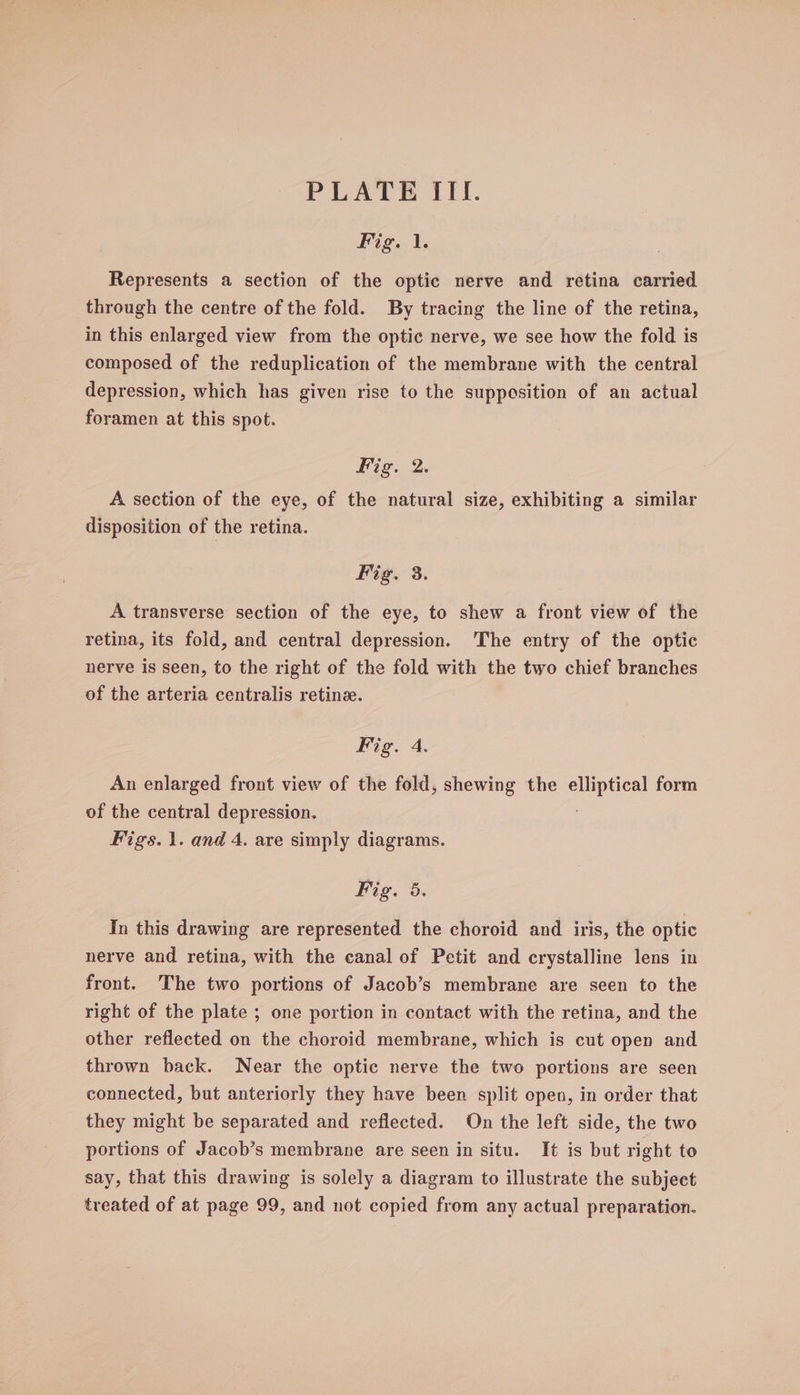 Fig. 1, Represents a section of the optic nerve and retina carried through the centre of the fold. By tracing the line of the retina, in this enlarged view from the optic nerve, we see how the fold is composed of the reduplication of the membrane with the central depression, which has given rise to the supposition of an actual foramen at this spot. Fis. 2. A section of the eye, of the natural size, exhibiting a similar disposition of the retina. Fig. 3. A transverse section of the eye, to shew a front view of the retina, its fold, and central depression. The entry of the optic nerve is seen, to the right of the fold with the two chief branches of the arteria centralis retine. Fig. 4. An enlarged front view of the fold, shewing the Se form of the central depression. Figs. 1. and 4. are simply diagrams. Fig. 5. In this drawing are represented the choroid and iris, the optic nerve and retina, with the canal of Petit and crystalline lens in front. The two portions of Jacob’s membrane are seen to the right of the plate ; one portion in contact with the retina, and the other reflected on the choroid membrane, which is cut open and thrown back. Near the optic nerve the two portions are seen connected, but anteriorly they have been split open, in order that they might be separated and reflected. On the left side, the two portions of Jacob’s membrane are seen in situ. It is but right to say, that this drawing is solely a diagram to illustrate the subject treated of at page 99, and not copied from any actual preparation.