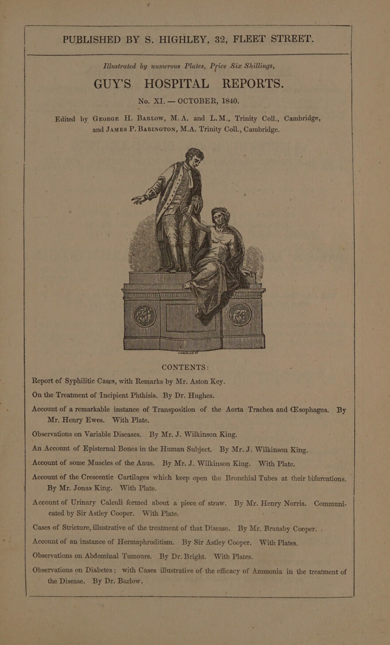 Tilustrated by numerous Plates, Price Sia Shillings, GUYS HOSPITAL REPORTS. No. XI. — OCTOBER, 1840. Edited by Greorce H. Bartow, M.A. and L.M., Trinity Coll., Cambridge, and JamEs P. Basineron, M.A. Trinity Coll., Cambridge. 9 CONTENTS: | Report of Syphilitic Cases, with Remarks by Mr. Aston Key. On the Treatment of Incipient Phthisis. By Dr. Hughes. Account of a remarkable instance of Transposition of the Aorta Trachea and (Esophagus. By Mr. Henry Ewes. With Plate. Observations on Variable Diseases. By Mr. J. Wilkinson King. An Account of Episternal Bones in the Human Subject, By Mr. J. Wilkinson King. Account of some Muscles of the Anus. By Mr. J. Wilkinson King. With Plate. Account of the Crescentic Cartilages which keep open the Bronchial Tubes at their bifurcations. By Mr. Jonas King. With Plate. Account of Urinary Caleuli formed about a piece of straw. By Mr. mae Norris. Communi- cated by Sir Astley Cooper. With Plate. Cases of Stricture, illustrative of the treatment of that Disease. By Mr. Bransby Cooper. Account of an instance of Hermaphroditism. By Sir Astley Cooper. With Plates. Observations on Abdominal Tumours. By Dr. Bright. With Plates. Observations on Diabetes; with Cases illustrative of the efficacy of Ammonia in the treatment of the Disease. By Dr. Barlow.