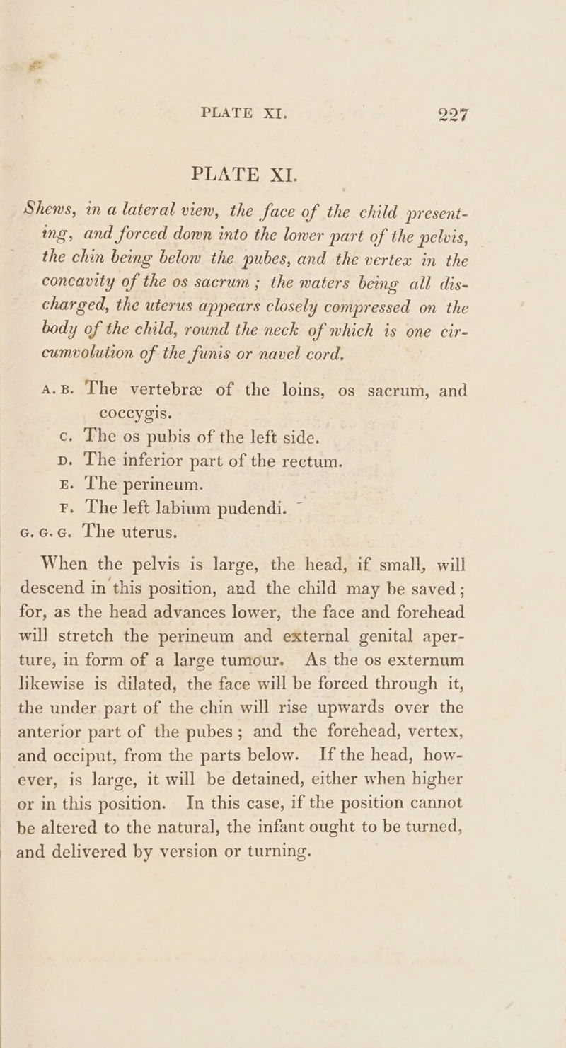 BEATE: XT: 99 bat | PEATE SL Shens, in a lateral view, the face of the child present- mg, and forced down into the loner part of the pelvis, the chin being below the pubes, and the vertex in the concavity of the os sacrum ; the waters being all dis- charged, the uterus appears closely compressed on the body of the child, round the neck of which is one cir- cumvolution of the funis or navel cord. A.B. The vertebre of the loins, os sacrum, and coccygis. . The os pubis of the left side. . The inferior part of the rectum. . The perineum. F. The left labium pudendi. ~ c.c.c. The uterus. Ee Se When the pelvis is large, the head, if small, will descend in this position, and the child may be saved ; for, as the head advances lower, the face and forehead will stretch the permeum and external genital aper- ture, in form of a large tumour. As the os externum likewise is dilated, the face will be forced through it, the under part of the chin will rise upwards over the anterior part of the pubes; and the forehead, vertex, and occiput, from the parts below. If the head, how- ever, is large, it will be detained, either when higher or in this position. In this case, if the position cannot be altered to the natural, the infant ought to be turned, _ and delivered by version or turning.