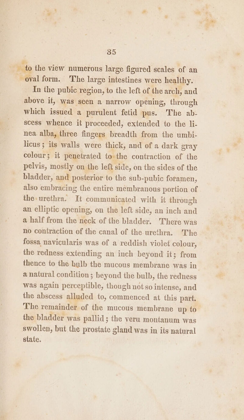 y Wate the view numerous large figured scales of an oval form. The large intestines were healthy. _ In the pubic region, to the left of the arch, and above it, was seen a narrow opening, through which issued a purulent fetid pus. The ab- scess whence it proceeded, extended to the li- nea alba, three fingers breadth from the umbi- licus; its walls were thick, and of a dark gray colour; it penetrated to. the contraction of the pelvis, mostly on the left side, on the sides of the bladder, and posterior to the sub-pubic foramen, also embracing the entire membranous portion of the: urethra. It communicated with it through an elliptic opening, on the left side, an inch and a half from the neck of the bladder. There was no contraction of the canal of the urethra. The fossa navicularis was of a reddish violet colour, the redness extending an inch beyond it; from thence to the bulb the mucous membrane was in. a natural condition ; beyond the bulb, the redness was again perceptible, though not so intense, and the abscess alluded to, commenced at this part. The remainder of the mucous membrane. up to the bladder was pallid; the veru montanum was swollen, but the prostate sland was in its natural state.