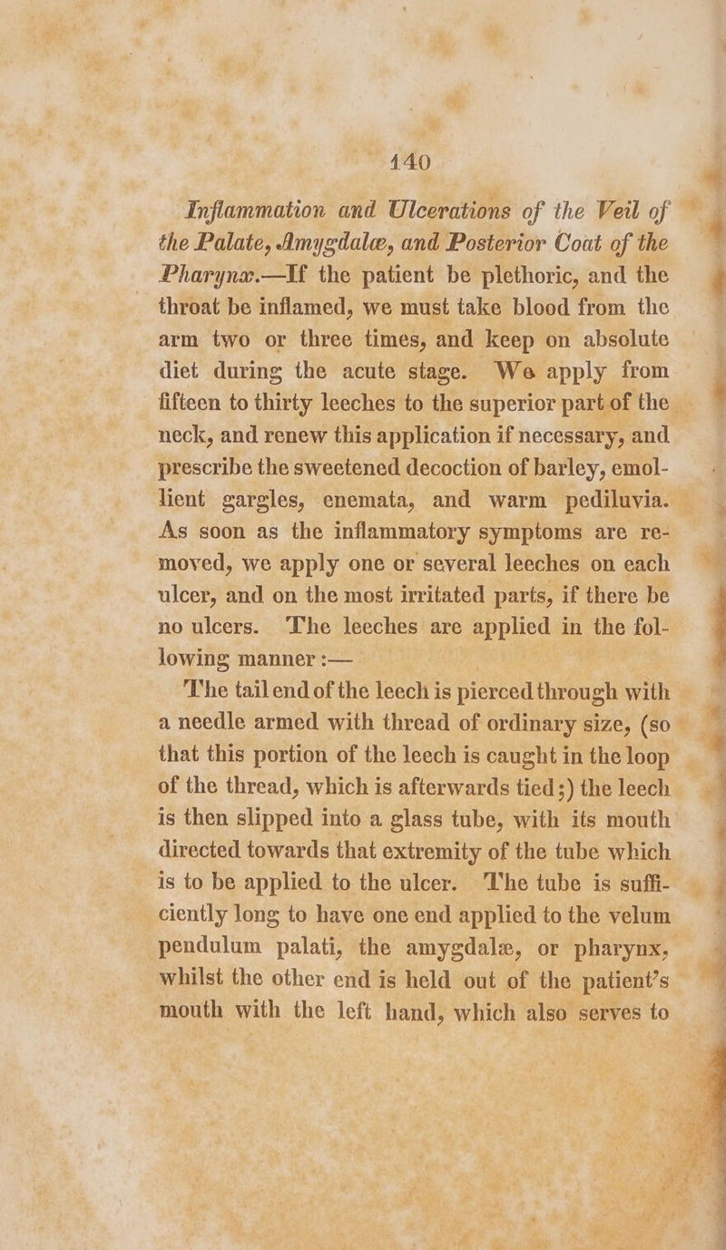 the Palate, Amygdalw, and Posterior Coat of the Pharynx.—If the patient be plethoric, and the throat be inflamed, we must take blood from the arm two or three times, and keep on absolute diet during the acute stage. We apply from fifteen to thirty leeches to the superior part of the neck, and renew this application if necessary, and prescribe the sweetened decoction of barley, emol- lient gargles, enemata, and warm pediluvia. As soon as the inflammatory symptoms are re- moved, we apply one or several leeches on each ulcer, and on the most irritated parts, if there be no ulcers. ‘The leeches are applied in the fol- lowing manner :— The tail end of the leech is pierced throug eh with that this portion of the leech is caught in the loop of the thread, which is afterwards tied;) the leech directed towards that extremity of the tube which is to be applied to the ulcer. The tube is suffi- ciently long to have one end applied to the velum pendulum palati, the amygdale, or pharynx, whilst the other end is held out of the patient’s mouth with the left hand, which also serves to