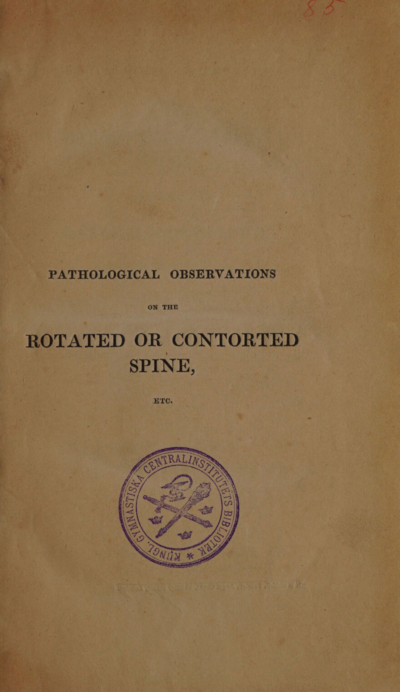 “So eee, PATHOLOGICAL OBSERVATIONS ON THE ROTATED OR CONTORTED SPINE, et Se
