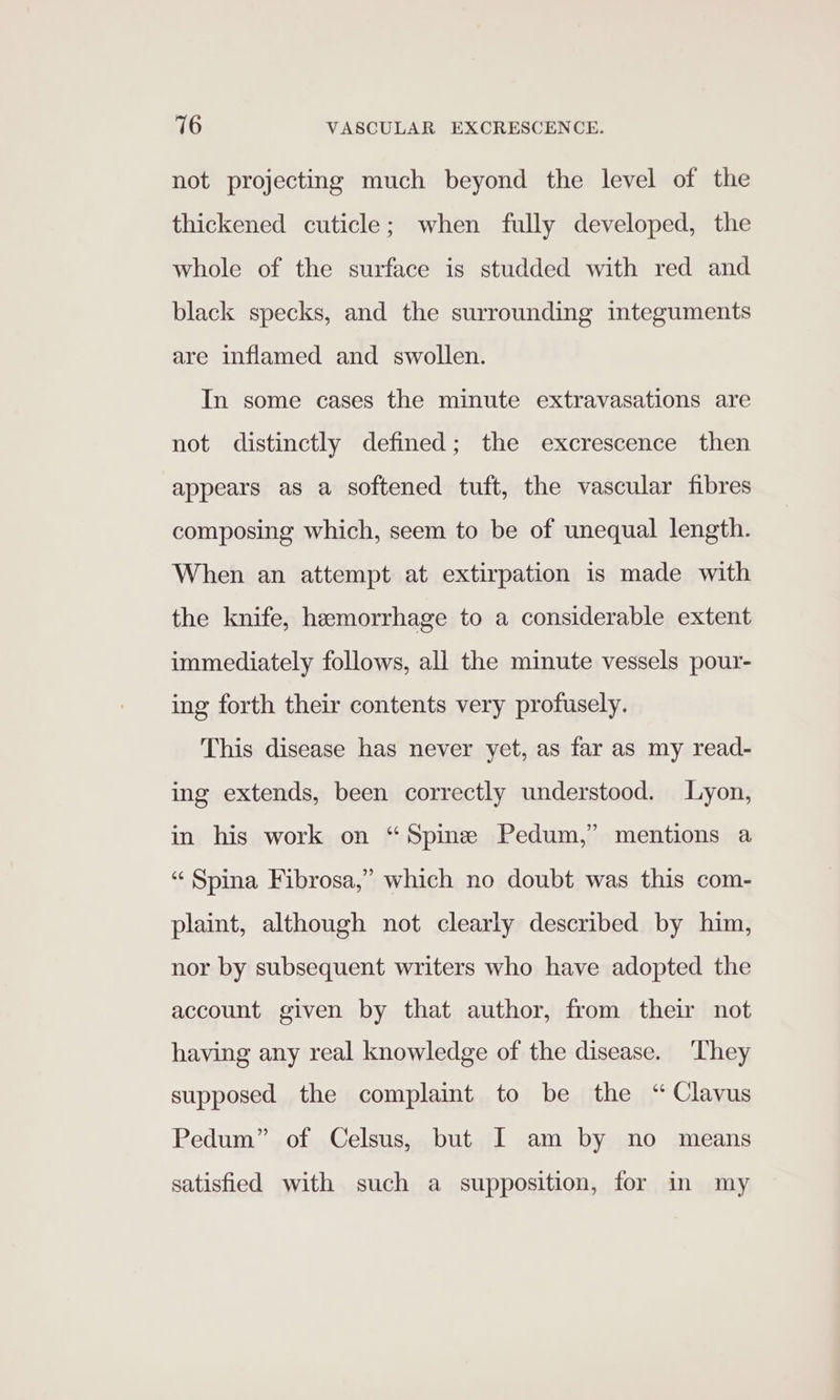 not projecting much beyond the level of the thickened cuticle; when fully developed, the whole of the surface is studded with red and black specks, and the surrounding integuments are inflamed and swollen. In some cases the minute extravasations are not distinctly defined; the excrescence then appears as a softened tuft, the vascular fibres composing which, seem to be of unequal length. When an attempt at extirpation is made with the knife, hemorrhage to a considerable extent immediately follows, all the minute vessels pour- ing forth their contents very profusely. This disease has never yet, as far as my read- ing extends, been correctly understood. Lyon, in his work on “Spine Pedum,” mentions a “Spina Fibrosa,” which no doubt was this com- plaint, although not clearly described by him, nor by subsequent writers who have adopted the account given by that author, from their not having any real knowledge of the disease. They supposed the complaint to be the “ Clavus Pedum” of Celsus, but I am by no means satisfied with such a supposition, for in my