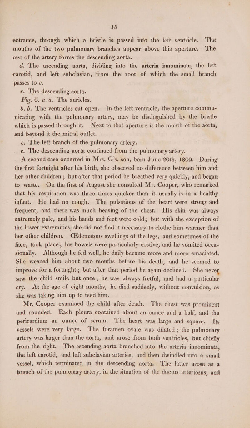 entrance, through which a bristle is passed into the left ventricle. ‘The mouths of the two pulmonary branches appear above this aperture. The rest of the artery forms the descending aorta. d. The ascending aorta, dividing into the arteria innominata, the left carotid, and left subclavian, from the root of which the small branch passes to @. e. ‘The descending aorta. fig. 6. a.a. The auricles. b. b. The ventricles cut open. In the left ventricle, the aperture commu- nicating with the pulmonary artery, may be distinguished by the bristle which is passed through it. Next to that aperture is the mouth of the aorta, and beyond it the mitral outlet. c. The left branch of the pulmonary artery. e. The descending aorta continued from the pulmonary artery. A second case occurred in Mrs. G’s. son, born June 20th, 1809. During the first fortnight after his birth, she observed no difference between him and her other children ; but after that period he breathed very quickly, and began to waste. On the first of August she consulted Mr. Cooper, who remarked that his respiration was three times quicker than it usually is in a healthy infant. He had no cough. The pulsations of the heart were strong and frequent, and there was much heaving of the chest. His skin was always extremely pale, and his hands and feet were cold; but with the exception of the lower extremities, she did not find it necessary to clothe him warmer than her other children. idematous swellings of the legs, and sometimes of the face, took place; his bowels were particularly costive, and he vomited occa- sionally. Although he fed well, he daily became more and more emaciated. She weaned him about two months before his death, and he seemed to improve for a fortnight ; but after that period he again declined. Shi never saw the child smile but once; he was always fretful, and had a particular cry. At the age of eight months, he died suddenly, without convulsion, as she was taking him up to feed him. Mr. Cooper examined the child after death. The chest was prominent and rounded. Each pleura contained about an ounce and a half, and the pericardium an ounce of serum. ‘The heart was large and square. Its vessels were very large. ‘The foramen ovale was dilated ; the pulmonary artery was larger than the aorta, and arose from both ventricles, but chiefly from the right. ‘The ascending aorta branched into the arteria innominata, the left carotid, and left subclavian arteries, and then dwindled into a small vessel, which terminated in the descending aorta. The latter arose as a branch of the pulmonary artery, in the situation of the ductus arteriosus, and