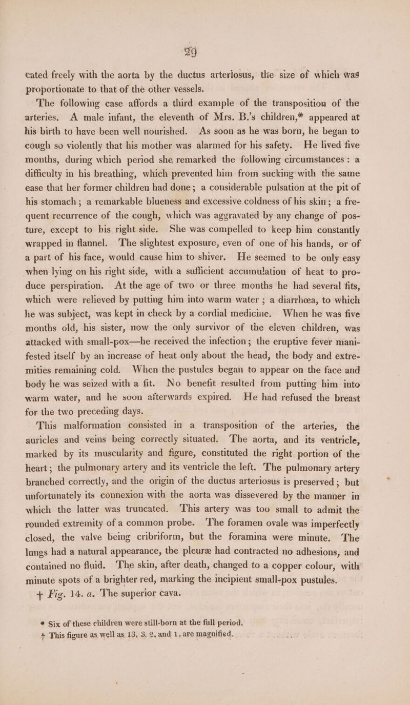 9 cated freely with the aorta by the ductus arteriosus, the. size of which was proportionate to that of the other vessels. The following case affords a third example of the transposition of the arteries, A male infant, the eleventh of Mrs. B.’s children,* appeared at his birth to have been well nourished. As soon as he was born, he began to cough so violently that his mother was alarmed for his safety. He lived five months, durmg which period she remarked the following circumstances : a difficulty in his breathing, which prevented him from sucking with the same ease that her former children had done; a considerable pulsation at the pit of his stomach; a remarkable blueness and excessive.coldness of his skin; a fre- quent recurrence of the cough, which was aggravated by any change of pos- ture, except to his right side. She was compelled to keep bim constantly wrapped in flannel. The slightest exposure, even of one of his hands, or of a part of his face, would cause him to shiver. He seemed to be only easy when lying on his right side, with a sufficient accumulation of heat to pro- duce perspiration. At the age of two or three months he had several fits, which were relieved by putting him into warm water ; a diarrhoea, to which he was subject, was kept in check by a cordial medicine. When he was five months old, his sister, now the only survivor of the eleven children, was attacked with small-pox—he received the infection; the eruptive fever mani- fested itself by an increase of heat only about the head, the body and extre- mities remaining cold. When the pustules began to appear on the face and body he was seized with a fit. No benefit resulted from putting him into warm water, and he soon afterwards expired. He had refused the breast for the two preceding days. This malformation consisted in a transposition of the arteries, the auricles and veins being correctly situated. The aorta, and its ventricle, marked by its muscularity and figure, constituted the right portion of the heart; the pulmonary artery and its ventricle the left. The pulmonary artery branched correctly, and the origin of the ductus arteriosus is preserved ; but unfortunately its connexion with the aorta was dissevered by the manner in which the latter was truncated. This artery was too small to admit the rounded extremity of a common probe. ‘T’he foramen ovale was imperfectly closed, the valve being cribnform, but the foramina were minute. The lungs had a natural appearance, the pleura had contracted no adhesions, and contained no fluid. The skin, after death, changed to a copper colour, with’ minute spots of a brighter red, marking the incipient small-pox pustules. + Fig. 14. a. The superior cava. * Six of these children were still-born at the full period. + This figure as well as 13, 3, 2, and 1, are magnified. |