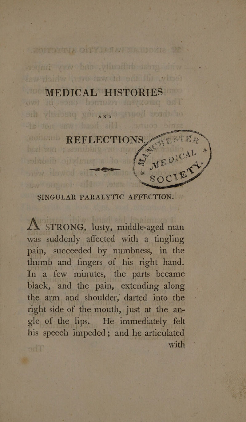 MEDICAL HISTORIES AND SINGULAR PARALYTIC AFFECTION. A STRONG, lusty, middle-aged man was suddenly affected with a tingling pain, succeeded by numbness, in the thumb and fingers of his right hand. In a few minutes, the parts became black, and the pain, extending along the. arm and shoulder, darted into the right side of the mouth, just at the an- gle of the lips. He immediately felt his speech impeded; and he articulated with