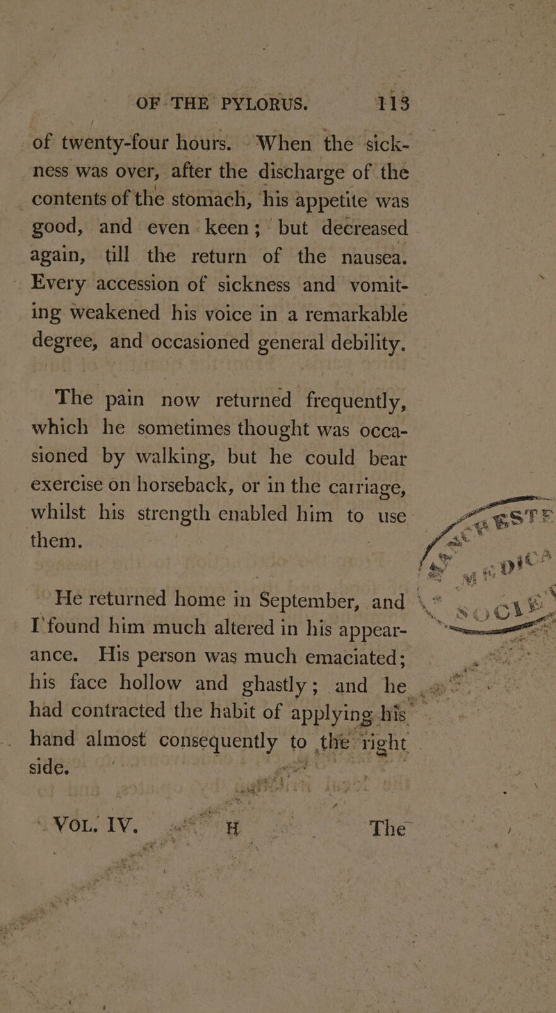 _ of twenty-four hours. ‘When the sick- ness was over, after the discharge of the contents of the stomach, ‘his appetite was good, and even keen; but decreased again, till the return of the nausea. Every accession of sickness and vomit- ing weakened his voice in a remarkable degree, and occasioned general debility. The pain now returned frequently, which he sometimes thought was occa- sioned by walking, but he could bear exercise on horseback, or in the carriage, whilst his strength enabled him to use them. I'found him much altered in his appear- ance. His person was much emaciated; had contracted the habit of applying. his” hand almost patie Sa to te: right | side. &amp; my SF ; ee ee Lake GVOL. IV, att Ht eT Be