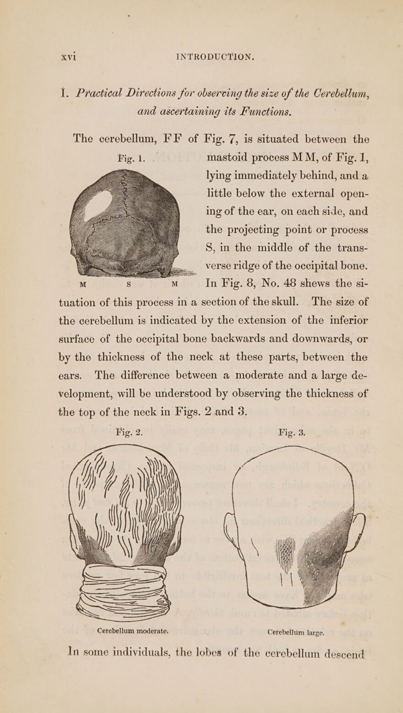 I. Practical Directions for observing the size of the Cerebellum, and ascertaining its Functions. The cerebellum, FF of Fig. 7, is situated between the mastoid process M M, of Fig. 1, lying immediately behind, and a little below the external open- ing of the ear, on each side, and the projecting point or process S, in the middle of the trans- _ verse ridge of the occipital bone. Fag Fig. 8, No. 48 shews the si- tuation of this process in a section of the skull. The size of the cerebellum is indicated by the extension of the inferior surface of the occipital bone backwards and downwards, or by the thickness of the neck at these parts, between the ears. The difference between a moderate and a large de- velopment, will be understood by observing the thickness of the top of the neck in Figs. 2 and 3. Fig. 2. Fig. 3. Cerebellum moderate, Cerebelltim large. In some individuals, the lobes of the cerebellum descend