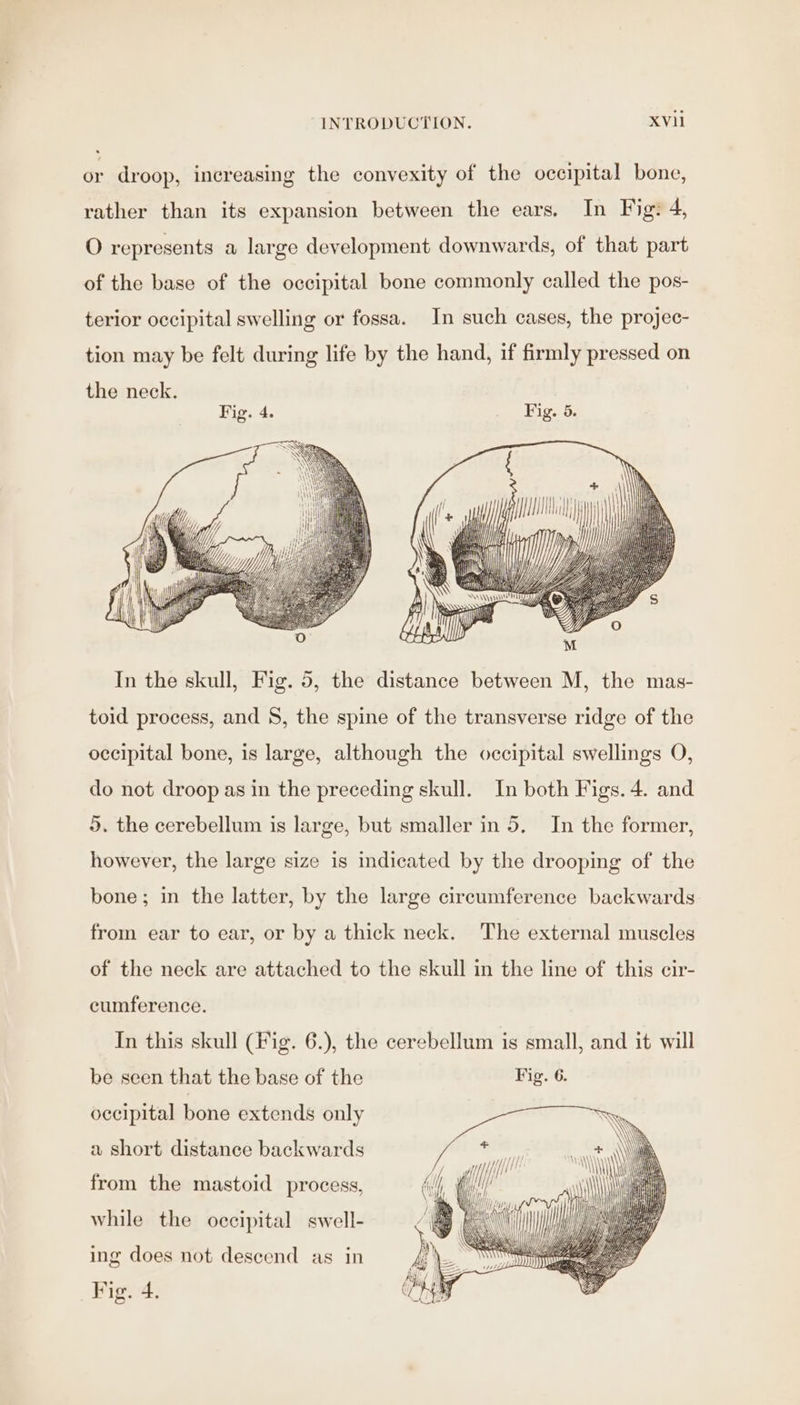 or droop, increasing the convexity of the occipital bone, rather than its expansion between the ears. In Fig: 4, O represents a large development downwards, of that part of the base of the occipital bone commonly called the pos- terior occipital swelling or fossa. In such cases, the projec- tion may be felt during life by the hand, if firmly pressed on the neck. M, il \ Al In the skull, Fig. 5, the distance between M, the mas- toid process, and $, the spine of the transverse ridge of the occipital bone, is large, although the occipital swellings O, do not droop as in the preceding skull. In both Figs. 4. and 5. the cerebellum is large, but smaller in 5. In the former, however, the large size is indicated by the drooping of the bone; in the latter, by the large circumference backwards from ear to ear, or by a thick neck. The external muscles of the neck are attached to the skull in the line of this cir- cumference. In this skull (Fig. 6.), the cerebellum is small, and it will be seen that the base of the Fig. 6. occipital bone extends only N \ NN &lt; \ a short distance backwards oH | ca VA D 2 ‘ /y) 0 MINI from the mastoid process, GH (i —— ‘My Hi while the occipital swell- i Mi (Pre PAT im ing does not descend as in Fig. 4.