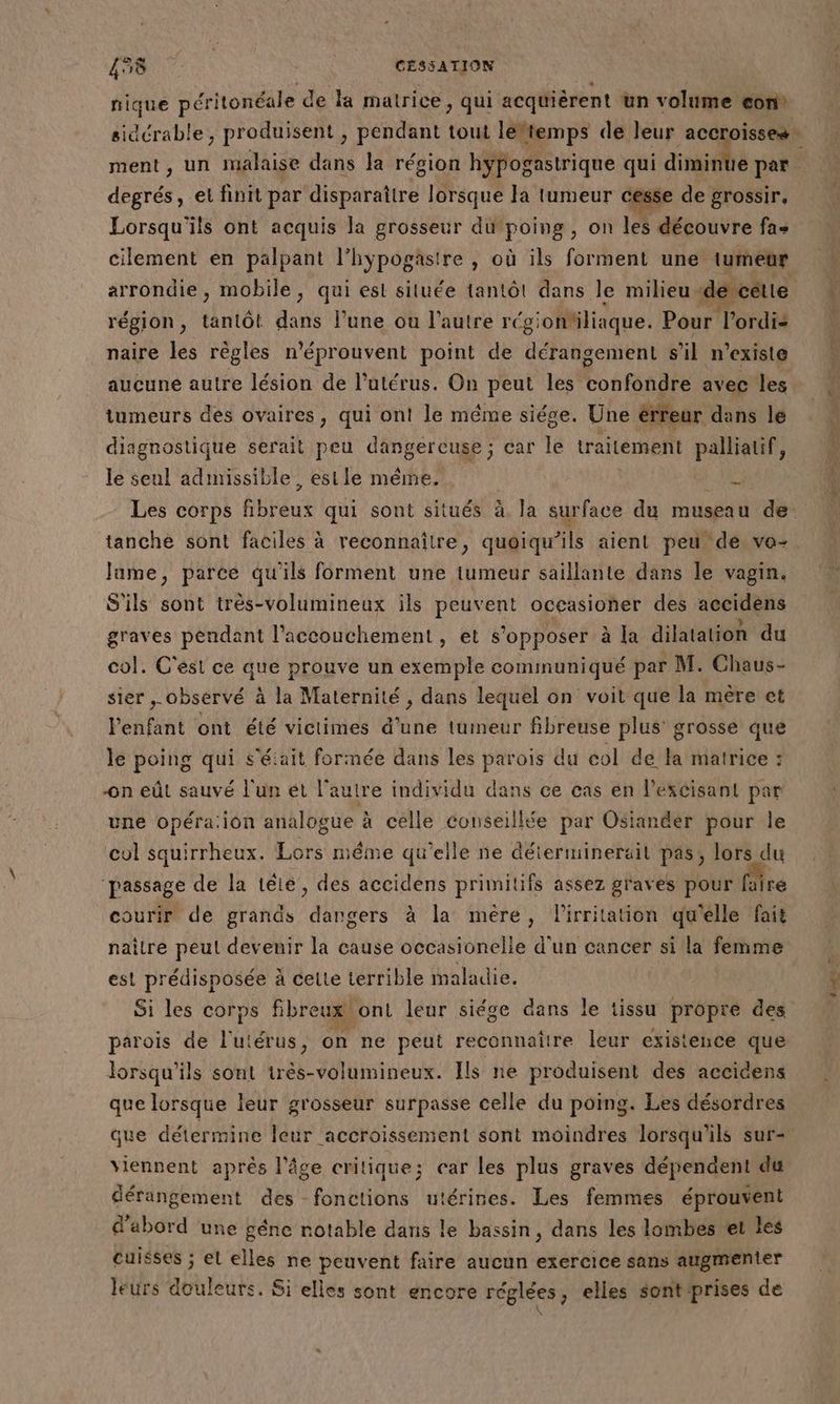 nique péritonéale d de Fa matrice, qui acquièrent un volume con ment, un malaise dans la région hypogastrique qui diminue par degrés, et finit par disparaître lorsque la tumeur cesse de grossir, Lorsqu'ils ont acquis la grosseur du ‘poing, on les découvre fas arrondie, mobile, qui est située tantôt dans le milieu ‘de celle région, tantôt dans l’une ou l’autre régi joniliaque. Pour l'ordis naire les règles n'éprouvent point de dérangement s’il n'existe tumeurs des ovaires, qui ont le méme siége. Une érfeur dans le diagnostique serait peu dangercuse ; car le traitement palliatif, le seul admissible, estle même. Je tanche sont faciles à reconnaître, quoiqu’ils aient peu de, vo- Jame, parce qu'ils forment une tumeur saillante dans le vagin. S'ils sont très-volumineux ils PRES occasioner des accidens graves pendant l'accouchement , et s'opposer à la dilatation du col. C'ési ce que prouve un exemple communiqué par M. Chaus- sier , observé à la Maternité , dans lequel on voit que la mère et l'enfant ont été victimes d’une tumeur Bbreuse plus’ grosse que le poing qui s'était formée dans les parois du col dé la matrice : -on eût sauvé l'un ét l’autre individu dans ce cas en lescisant par une opéra.ion analogue à celle conseillée par Osiander pour le col squirrheux. Lors méme qu'elle ne déterminerait pas, lors du “passage de la teié, des accidens primitifs assez graves pour faire courir de grands dangers à la mère, l'irritation qu'elle fait est prédisposée à celte terrible maladie, Si les corps fibreux ont leur siége dans le tissu propre des parois de l'ütdrus on ne peut reconnaitre leur existence que lorsqu'ils sont irès-volumineux. Ils ne produisent des accidens que lorsque leur grosseur surpasse celle du poing. Les désordres que détermine leur accroissenient sont moindres lorsqu'ils sur- viennent après l’âge critique; car les plus graves dépendent du dérangement des fonctions utérines. Les femmes éprouvent d'abord une géne notable dans le bassin, dans les lombes et les cuisses ; et elles ne peuvent faire aucun exercice sans augmenter leurs douleurs. Si elles sont encore réglées, elles sont prises de PET, trés Le