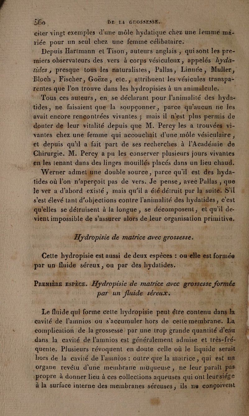 citer vingt exemples d'une môle hydatique chez une femme mä- riée pour un seul chez une femme célibataire. | Depuis Hartmann et Tison, auteurs anglais , qui sont les pre- miers observatèurs des vers à corps vésiculeux, appelés Xyda- rentes que l’on trouve dans les hydropisies à un animaleule. - Tous ces auteurs, en se déclarant pour l'animalité des hyda: tides, ne faisaient que la soupçonner, parce qu'aucun ne Îes avail encore rencontrées vivantes ; mais il nest plus permis de douter de leur vitalité depuis que M. Percy les a trouvées vi- vantes chez une femme qui accouchait d’une môle vésiculaire ; et depuis qu'il a fait part de ses recherches à l’Académie de Chirurgie. M. Percy a pu les conserver plusieurs jours vivantes ‘en les tenant dans des linges mouillés placés dans un lieu chaud. Werner admelne double source, parce qu'il est des hyda- tides où l’on n’aperçoit pas de vers. Je pense, avec Pallas , que le ver a d’abord existé, mais qu’il a étédétruit par la suitét S'il s’est élevé tant d’objections contre l'animalité des hydatides , c'est qu’elles se détruisent à la longue , se décomposent, et qu'il de- vient impossible de s'assurer alors de leur organisation primitive. a nu repli de Le avec grossesse. par un fluide Séreux , ou par des sr ais a As PremiÈne ESPÈCE. Hydropisie de matrice avec gross. par‘ un PRE sÉreuX dans la cavité de l'amnios est générälement admise et très- -fré organe revêtu d’une meinbrane muqueuse, ne DE parait F «propre à donner lieu à ces collections aqueuses qui ont leursiége à la surface interne des membranes séreuses, ils ne congçoivent Lee