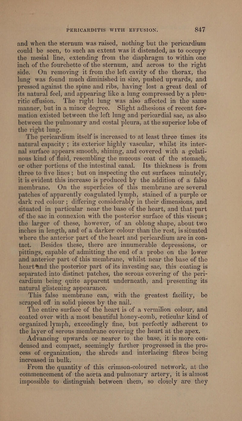 / PERICARDITIS WITH EFFUSION. 847 and when the sternum was raised, nothing but the pericardium could be seen, to such an extent was it distended, as to occupy the mesial line, extending from the diaphragm to within one inch of the fourchette of the sternum, and across to the right side. On removing it from the left cavity of the thorax, the lung was found much diminished in size, pushed upwards, and pressed against the spme and ribs, having lost a great deal of its natural feel, and appearing like a lung compressed by a pleu- ritic effusion. The right lung was also affected in the same manner, but in a minor degree. Slight adhesions of recent for- mation existed between the left lung and pericardial sac, as also between the pulmonary and costal pleura, at the superior lobe of the right lung. The pericardium itself is increased to at least three times its natural capacity ; its exterior highly vascular, whilst its inter- nal surface appears smooth, shining, and covered with a gelati- nous kind of fluid, resembling the mucous coat of the stomach, or other portions of the intestinal canal. Its thickness is from three to five lines ; but on inspecting the cut surfaces minutely, it is evident this increase is produced by the addition of a false membrane. On the superficies of this membrane are several patches of apparently coagulated lymph, stained of a purple or dark red colour ; differing considerably in their dimensions, and situated in particular near the base of the heart, and that part of the sac in connexion with the posterior surface of this viscus ; the larger of these, however, of an oblong shape, about two inches in length, and of a darker colour than the rest, is situated where the anterior part of the heart and pericardium are in con- tact. Besides these, there are innumerable depressions, or pittings, capable of admitting the end of a probe on the lower and anterior part of this membrane, whilst near the base of the heart nd the posterior part of its investing sac, this coating is separated into distinct patches, the serous covering of the peri- eardium being quite apparent underneath, and presenting its natural glistening appearance. This false membrane can, with the greatest tly ahi be scraped off in solid pieces by the nail. 3 The entire surface of the heart is of a vermilion colour, and coated over with a most beautiful honey-comb, reticular kind of organized lymph, exceedingly fine, but perfectly adherent to the layer of serous membrane covering the heart at the apex. Advancing upwards or nearer to “the base, 1t 1s more con- densed and compact, seemingly farther progressed in the pro- cess of organization, the shreds and interlacing fibres being increased in bulk. From the quantity of this crimson-coloured network, at the commencement of the aorta and pulmonary artery, it is almost impossible to distinguish between them, so closely are they