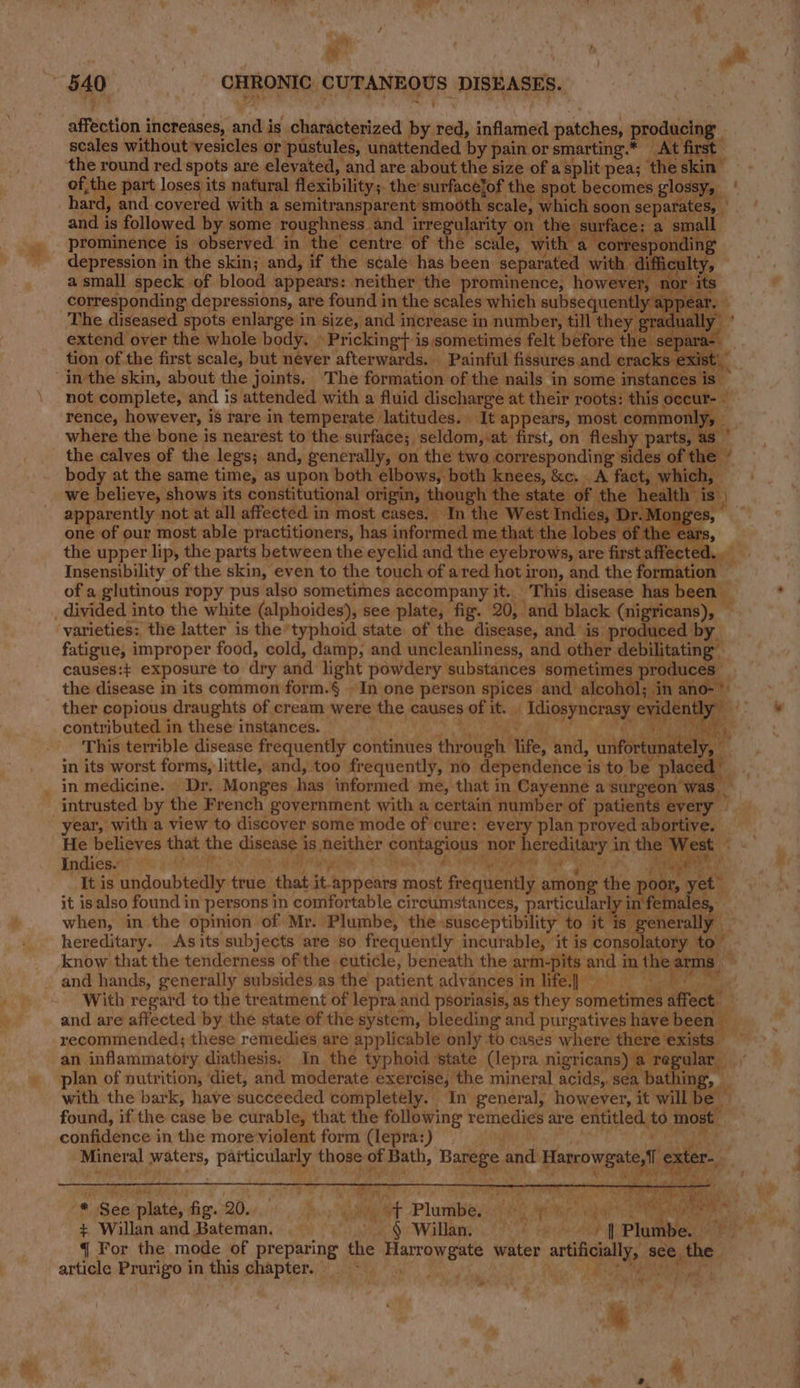 iy . ie . | at affection i increases, arid is characterized _ i ant inflamed patches, produci scales without vesicles or’ pustules, unattended by } pain or smarting.* At a the round red spots are elevated, and are about the size of a split pea; the skin of, ithe part loses its natural flexibility 5. the’ surfacefof the spot becomes glossy, hard, and covered with a semitransparent smooth scale, which | soon separates, and is followed by some roughness | and irregularity on. ‘the surface: prominence is observed in the centre of the scale, wit correspondin depression in the skin; and, if the scale has been prin Sy with @ icult; a small speck of blood appears: neither the prominence, ed ‘nor its corresponding depressions, are found in the scales which subsequentl y app Bais diseased es se of Sa and increase i in bile pais ey Hed upper lip, the parts iy orion the orchid and the ce ent te te * Insensibility of the skin, even to the touch of ared hot iron, and the Torenstiot of a glutinous ropy pus also sometimes accompany a This disease has | een db varieties: the latter is the typhoid state of the disease, and. is. pire fatigue, i improper food, cold, damp, and uncleanliness, and. other de aitating” causes:+ exposure to dry and light powdery substances. ‘sometimes produces . the disease in its common form.§ ~In one person spices and alcohol; in ano-* ther copious draughts of cream were the causes of it. Idiosyncrasy evidenth _: © contributed in these instances. * Ws This terrible disease frequently continues through. mig! and, antec, : in its worst forms, little, and, too frequently, no dependence is to be placed in medicine. Dr. Monges has informed me, that in Cayenne a surgeon a year, with a view to discover some mode of cure: every plan proved ees ; He believes that the disease i is aera conhigions, nor an at the Indies.46 % yeh Mee it It is undoubtedly true ‘that: i Sopckes most frequently among the poor yet it isalso found in persons in comfortable circumstances, particularly in’ ales, when, in the opinion of Mr. Plumbe, the. “susceptibility to gt tonal hereditary. Asits subjects are so frequently incurable, it is consolatory » to 4 know that the tenderness of'the cuticle, beneath the arm-pits and i in the: ore pe # With regard to the treatment of lepra 2 and psoriasis, as they someting’ wreak and are affected by the state of the system, bleeding and purgatives have beer recommended; these remedies are’ applicable only to cases where th re ex an inflammatory diathesis, In the typhoid ‘state (lepra nigricans) t le: plan. of nutrition, ‘diet, and moderate exercise, the mineral acids,. s ee * hae ‘plate, fig. 20. i ra ae ‘Plospere one tags Hips bis + Willan. and Bateman. . i § Willan, ni ac sed ‘ Pindie 4 For the mode of preparing the Harrowgate y water mes sce, ihe article Prurigo in this chapter. ~~ | ta Me