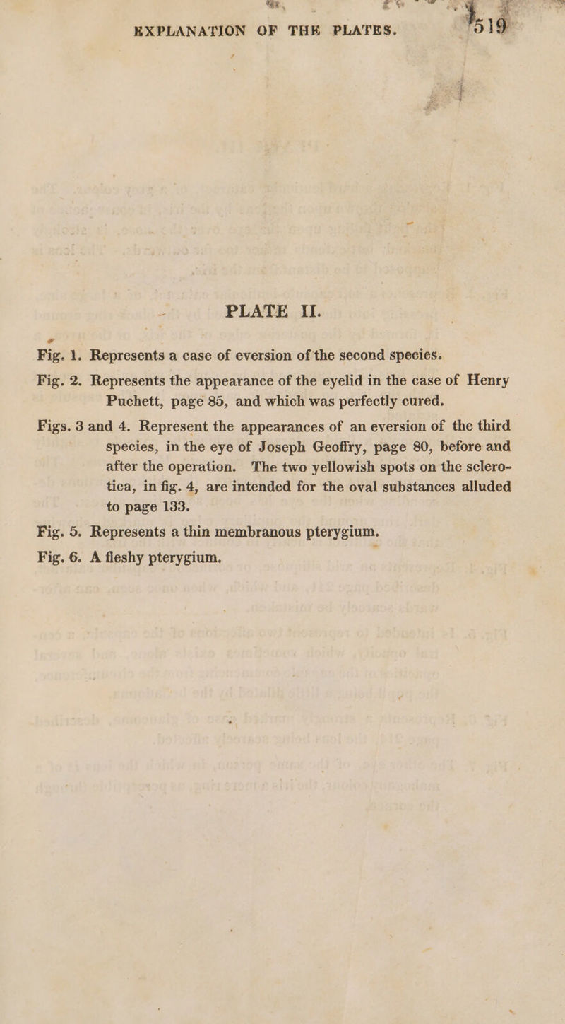 - PLATE II. Ff Fig. 1. Represents a case of eversion of the second species. Fig. 2. Represents the appearance of the eyelid in the case of Henry Puchett, page 85, and which was perfectly cured. Figs. 3 and 4. Represent the appearances of an eversion of the third species, in the eye of Joseph Geoffry, page 80, before and after the operation. The two yellowish spots on the sclero- tica, in fig. 4, are intended for the oval substances alluded to page 133. Fig. 5. Represents a thin membranous pterygium. Fig. 6. A fleshy pterygium.