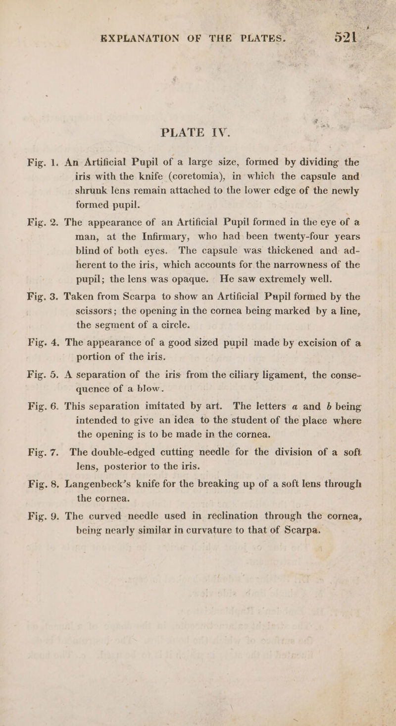 PLATE IV. iris with the knife (coretomia), in which the capsule and shrunk lens remain attached to the lower edge of the newly formed pupil. man, at the Infirmary, who had been twenty-four years blind of both eyes. The capsule was thickened and ad- herent to the iris, which accounts for the narrowness of the pupil; the lens was opaque. He saw extremely well. scissors; the opening in the cornea being marked by a line, the segment of a circle. portion of the iris. quence of a blow. intended to give an idea to the student of the place where the opening is to be made in the cornea. The double-edged cutting needle for the division of a soft lens, posterior to the iris. the cornea. being nearly similar in curvature to that of Scarpa.