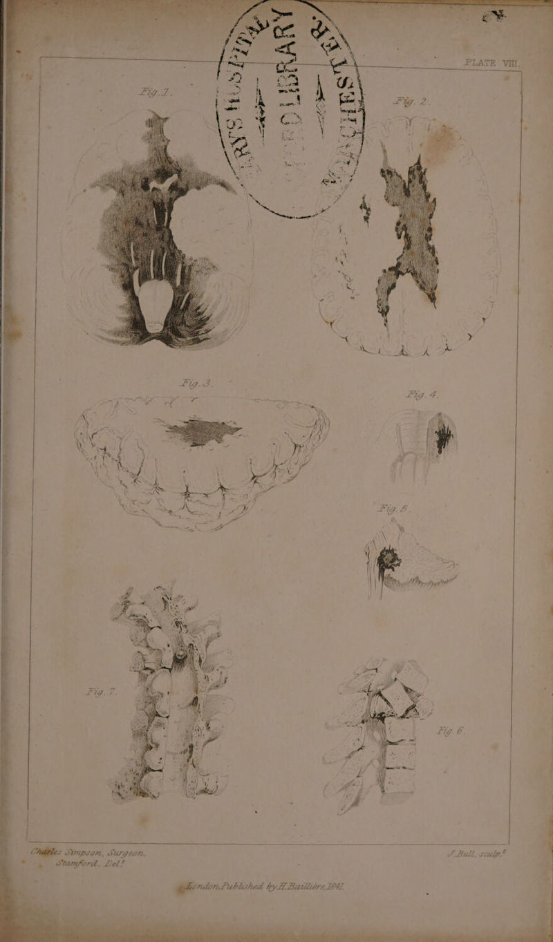 PLATE VIII. Fig. 3. S Bull, scudp.? S SUNPEOI, SUPGEOM, 7. Lublished by H Bailiitre 184. gelenacn &amp; Stamford, Lel