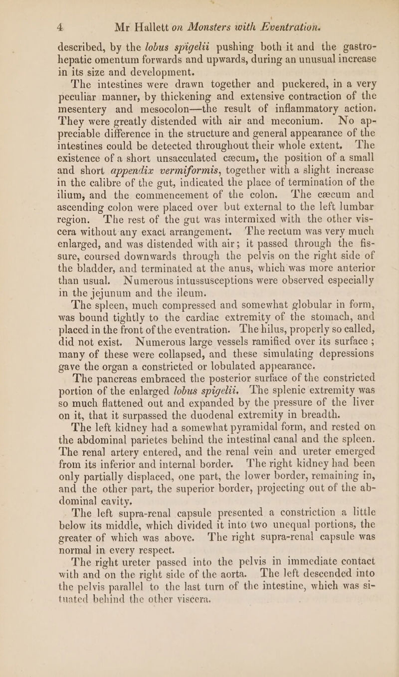 described, by the lobus spigelit pushing both it and the gastro- hepatic omentum forwards and upwards, during an unusual increase in its size and development. The intestines were drawn together and puckered, in a very peculiar manner, by thickening and extensive contraction of the mesentery and mesocolon—the result of inflammatory action. They were greatly distended with air and meconium. No ap- preciable difference in the structure and general appearance of the intestines could be detected throughout their whole extent. ‘The existence of a short unsacculated caecum, the position of a small and short appendix vermiformis, together with a slight increase in the calibre of the gut, indicated the place of termination of the ilium, and the commencement of the colon. ‘The caecum and ascending colon were placed over but external to the left lumbar region. The rest of the gut was intermixed with the other vis- cera without any exact arrangement. ‘The rectum was very much enlarged, and was distended with air; it passed through the fis- sure, coursed downwards through the pelvis on the right side of the bladder, and terminated at the anus, which was more anterior than usual. Numerous intussusceptions were observed especially in the jejunum and the ileum. The spleen, much compressed and somewhat globular in form, was bound tightly to the cardiac extremity of the stomach, and placed in the front of the eventration. ‘The hilus, properly so called, did not exist. Numerous large vessels ramified over its surface ; many of these were collapsed, and these simulating depressions gave the organ a constricted or lobulated appearance. The pancreas embraced the posterior surface of the constricted portion of the enlarged lobus spigelit. ‘Lhe splenic extremity was so much flattened out and expanded by the pressure of the liver on it, that it surpassed the duodenal extremity in breadth. The left kidney had a somewhat pyramidal form, and rested on the abdominal parietes behind the intestinal canal and the spleen. The renal artery entered, and the renal vein and ureter emerged from its inferior and internal border. The right kidney had been only partially displaced, one part, the lower border, remaining in, and the other part, the superior border, projecting out of the ab- dominal cavity. The left supra-renal capsule presented a constriction a little below its middle, which divided it into two unequal portions, the greater of which was above. The right supra-renal capsule was normal in every respect. The right ureter passed into the pelvis in immediate contact with and on the right side of the aorta. The left descended into the pelvis parallel to the last turn of the intestine, which was si- tuated behind the other viscera.