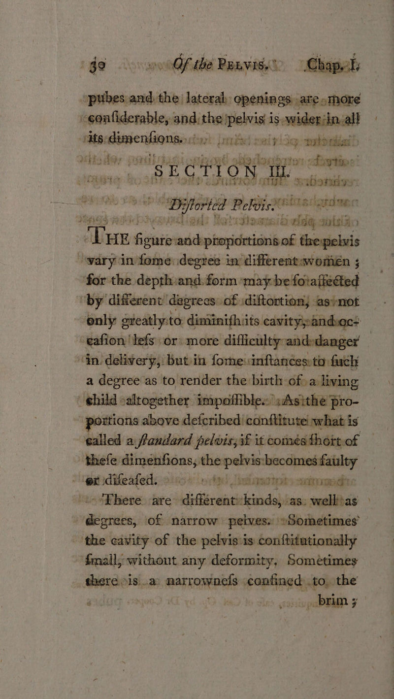 pooruenant the lateral, openings. vate oThore i gee conn is wider in. all ae bert Une) wel y ie eabonidell sass oi cyl aigdoupgton: begins wi “SECTIO IN UREA ey th af COOIOd aE, seubowadwe : sported Pelvis.’ Ritsclgrdwer id yaudieads Roti ttasns 6 edg@ aplsiic ek Due E fieute shaper thepelvis “wary in fome:idegree in differentwomien ; for the depth:and. form may befotafieated “by different’ dagrecs of diftortion) ‘asnot only greatly:to diminifluits cavitypandvect -eafion 'lefs or) more difficulty andedanger “Gn. delivery, butiin fome:inftancestia fuch a degree as to render the birth: of» a living | ghild saltogether impoffiblex ah ‘portions. above defcribed | conftitute! what i ealled a fanilard pelvis; i£ it comésthort of i thele miele Sain nes fai d or idifeafed. — diac) [palaacto) anime: -*Ehere are’ Jasna kinds, as: wellias the cavity of the pelvis is conftitutionally a fmall,; without any deformity, Sométimes ROS cs iaiiadoii §eighee .to, the IGE r2qoe Cy io) We a brum 3 eo