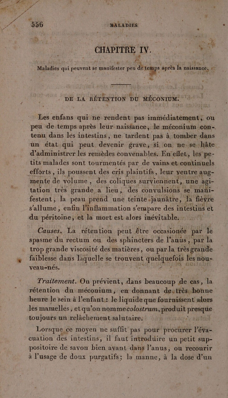 de CHAPITRE IN. RE 6 À Vu USE PRES . Ê e Maladies qui eue se : manifester peu ‘dé gp après la naissance, # + Fran TL : dr Î DE LA RÉTENTION DU MÉCONIUM.. Les enfans qui ne rendent pas immédiatement ; où peu de temps après leur naissance, ‘le méconium con. tenu dans lés intestins, ne istfinéi pas à tomber dans üun état qui peut, devenir grave, Si on nñe:se.-hâte d’administrer les remèdes convenables. En'eflet, les pe- tits malades sont tourmentés par de vainset continuels efforts, ils poussent des cris plaintifs, leur ventre aug- mente de volume , des coliques surviennent, une agi- tation trés grande a lieu, des convulsions se mañi- festent, la peau prénd une teinte-jaunâtre, pes fièvre $ Le enfin l’inflammation s ’empare des intestins et du péritoine , ‘et la mort est alors inévitable. : Causes. La ‘rétention peut Ale occasionée par {e spasme du rectum ou des sphincters de l'anus, par la trop grande viscosité des matières, ou par. la très grande faiblesse dans laquelle &lt; se trouvent quelquefois les nou- CE 10 veau-nés. | De AN MDI SE M Ta rrattemielts On prévient, dans beaucoup de cas , # heure le sein à l’enfant:: le liquide que fournissent alors les mamelles , et qu’on nommecolostrum, EME a toujours un relâchement salutaire: ns dur e RAYON Lorsque, ce moyen ne suffit pas pour proctter PEYae à l’usage de doux purgatifs; la manne, à la dose d’un