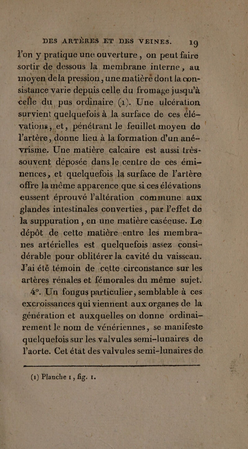DES ARTÈRES ET DES VEINES. 19 l’on y pratique une ouverture, on peut faire sortir de dessous la membrane interne, au moyen dela pression , une matièré dont la con- sistance varie depuis celle du fromage jusqu’à celle du pus ordinaire (1). Une ulcération survient quelquefois à à la surface de ces élé- vations, et, pénétrant le feuillet moyen de l'artère, donne lieu à la formation d’un ané- vrisme. Une matière calcaire est aussi très- souvent déposée dans le centre de ces émi- nences, et quelquefois la surface de l’artére offre la même apparence que si ces élévations eussent éprouvé l’altération commune. aux glandes intestinales converties, par l'effet de la suppuration , en une matière caséeuse. Le dépôt de cette matiëre-entre les membra- nes artérielles est quelquefois assez consi- dérable pour oblitérer la cavité du vaisseau. J'ai été témoin de cette circonstance sur les artères rénales et fémorales du même sujet. 4°. Un fongus particulier, semblable a ces excroissances qüi viennent aux organes de la génération et auxquelles on donne ordinai- rement le nom de vénériennes, se manifeste quelquefois sur les valvules semi-lunaires de l'aorte. Cet état des valvules semi-lunaires de 9 rrr re ee ce SET VEAP CRE A FET IT I I LT REP I