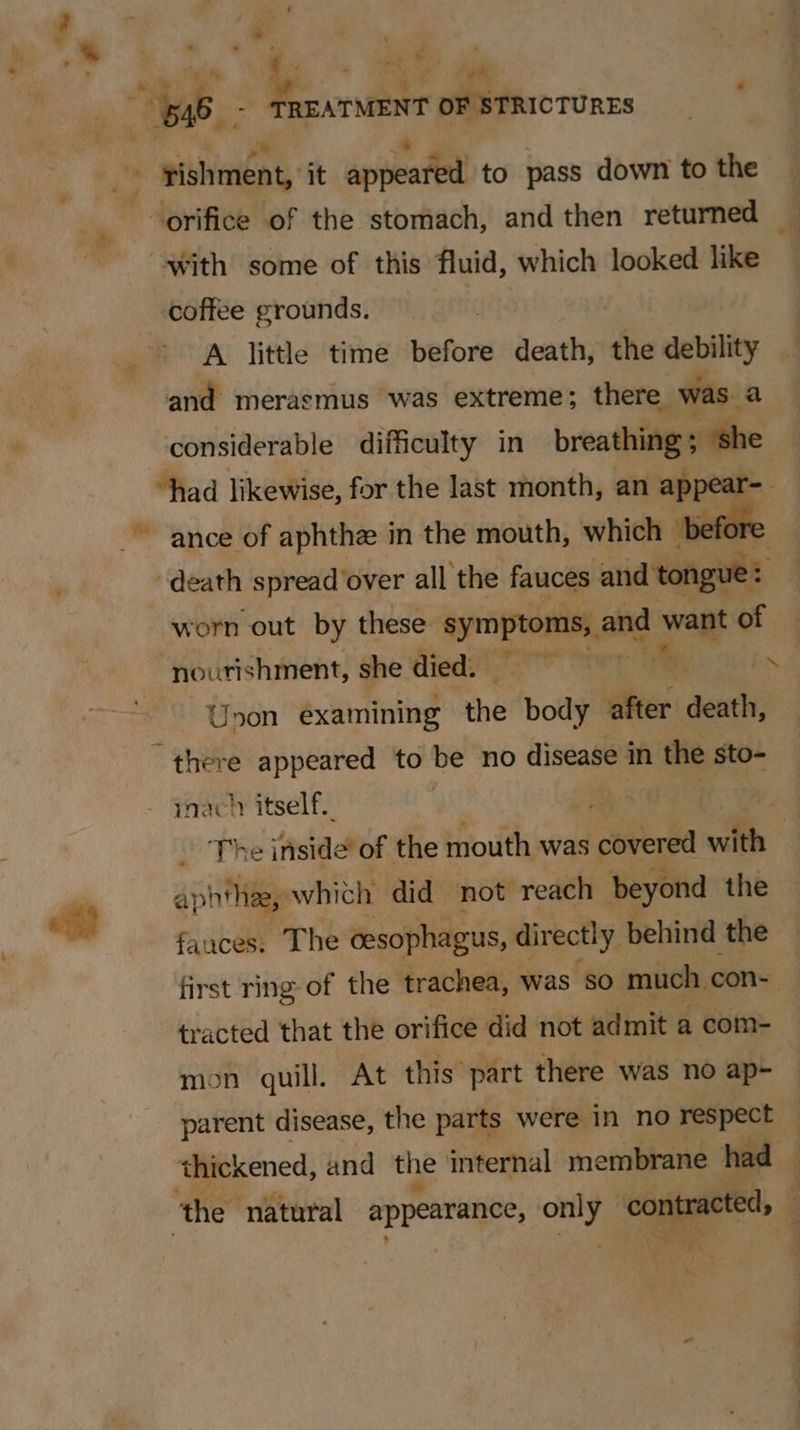 e ; _» ee ; ee OF STRICTURES —- - rishment, it appeated to pass down to the “with some of this fluid, which looked like coffee grounds. and merasmus was extreme; there was a “had likewise, for the last month, an ap death spread over all the fauces and’ tongue worn out by these symptoms, and want of Unon examining the body thes death, - there appeared to be no disease in the sto- - qnacl itself. 2 ai ig whith did not reach beyond the fauces. The cesophagus, directly behind the tracted that the orifice did not admit a com- mon quill. At this part there was no ap-