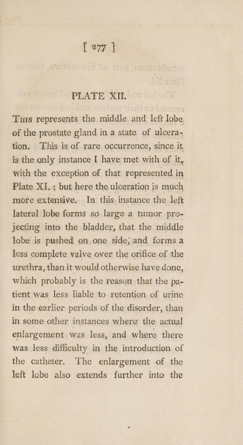 PLATE XIt. Tus represents the middle and. left lobe. of the prostate gland in a state of ulcera- tion. This is of rare occurrence, since it, is the only instance I have met with of it, With the exception of that represented in Plate XI.; but here the ulceration is much more extensive. In this. instance the left lateral lobe forms so large a tumor pro- jecting into the bladder, that the middle lobe is pushed on,one side; and forms.a less complete valve over the orifice of the urethra, than it would otherwise have.done, which probably is the reason that the pa- tient was less liable to retention. of urine in the earlier periods of the disorder, than in some other instances where the actual enlargement. was less, and where there was less difficulty in the introduction of the catheter. The enlargement of the left lobe also extends further into the