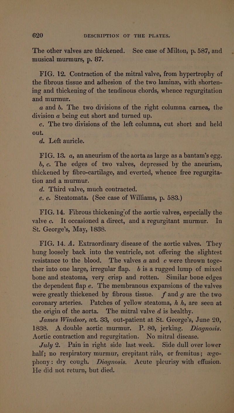 The other valves are thickened. See case of Milton, p. 587, and musical murmurs, p. 87. FIG. 12. Contraction of the mitral valve, from hypertrophy of the fibrous tissue and adhesion of the two lamine, with shorten- ing and thickening of the tendinous chords, whence regurgitation and murmur. : a and b. The two divisions of the right columna carnea, the division a being cut short and turned up. c. The two divisions of the left columna, cut shock and held out. d. Left auricle. FIG. 13. a, an aneurism of the aorta as large as a bantam’s egg. b,c. The edges of two valves, depressed by the aneurism, thickened by fibro-cartilage, and everted, whence free regurgita- tion and a murmur. d. Third valve, much contracted. e.e. Steatomata. (See case of Williams, p. 583.) FIG. 14. Fibrous thickening of the aortic valves, especially the valve c. It occasioned a direct, and a regurgitant murmur. In St. George’s, May, 1838. FIG. 14. A. Extraordinary disease of the aortic valves. They hung loosely back into the ventricle, not offering the slightest resistance to the blood. ‘The valves a and c¢ were thrown toge- ther into one large, irregular flap. 61s a rugged lump of mixed bone and steatoma, very crisp and rotten. Similar bone edges the dependent flap e. The membranous expansions of the valves were greatly thickened by fibrous tissue. f and g are the two coronary arteries. Patches of yellow steatoma, h, are seen at the origin of the aorta. The mitral valve d is healthy. James Windsor, et. 33, out-patient at St. George’s, June 20, . 1838. A double aortic murmur. P. 80, jerking. Diagnosis. Aortic contraction and regurgitation. No mitral disease. July 2. Pain in right side last week. Side dull over lower half; no respiratory murmur, crepitant rale, or fremitus; sego- phony: dry cough. Diagnosis, Acute pleurisy with effusion. He did not return, but died.
