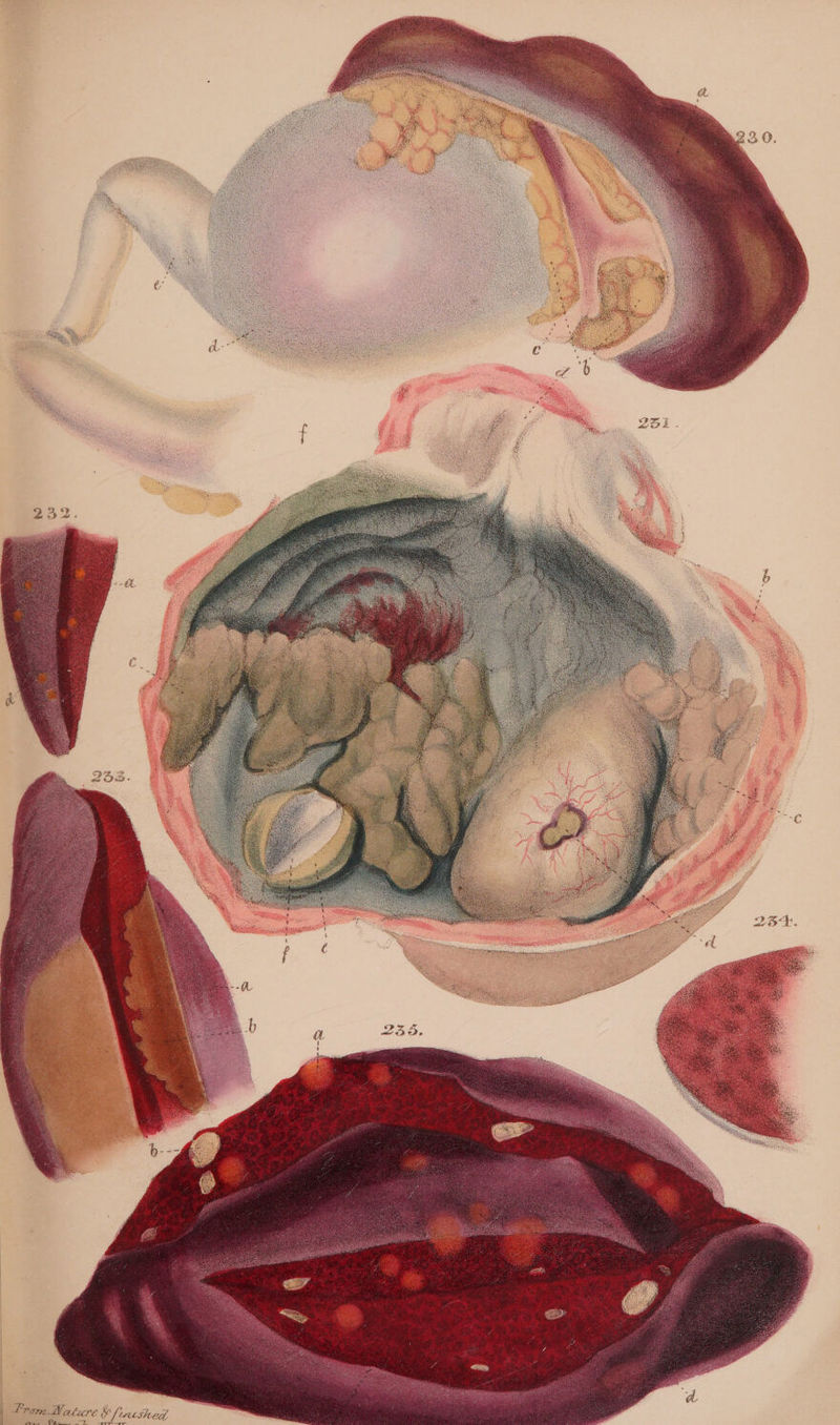 aapeticeuax