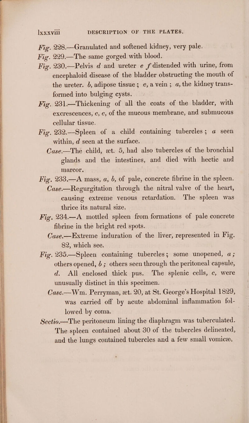 Fig. 228.—Granulated and softened kidney, very pale. Fig. 229.—The same gorged with blood. Fig. 230.—Pelvis d and ureter e f distended with urine, from encephaloid disease of the bladder obstructing the mouth of the ureter. 0, adipose tissue; ¢,a vein; a, the kidney trans- formed into bulging cysts. Fig. 231.—Thickening of all the coats of the bladder, with excrescences, ¢, c, of the mucous membrane, and submucous cellular tissue. Fig. 232.—Spleen of a child containing tubercles ; @ seen within, d seen at the surface. Case.—The child, zt. 5, had also tubercles of the bronchial glands and the intestines, and died with hectic and marcor. Fig. 233.—A mass, a, 6, of pale, concrete fibrine in the spleen. Case-—Regurgitation through the nitral valve of the heart, causing extreme venous retardation. ‘The spleen was thrice its natural size. Fig. 234.—A mottled spleen from formations of pale concrete fibrine in the bright red spots. Case.—Extreme induration of the liver, represented in Fig. 82, which see. Fig. 235.—Spleen containing tubercles; some unopened, a; others opened, 4; others seen through the peritoneal capsule, d. All enclosed thick pus. The splenic cells, c, were unusually distinct in this specimen. Case-—Wnm. Perryman, et. 20, at St. George’s Hospital 1829, was carried off by acute abdominal inflammation fol- lowed by coma. | Sectio—The peritoneum lining the diaphragm was tuberculated. The spleen contained about 30 of the tubercles delineated, and the lungs contained tubercles and a few small vomicze.