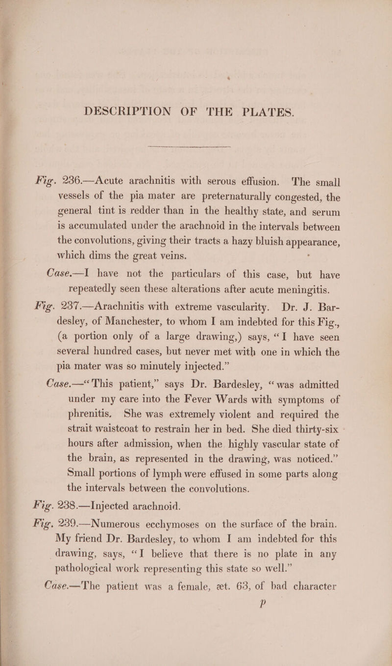 DESCRIPTION OF THE PLATES. fig. 236.—Acute arachnitis with serous effusion. The small vessels of the pia mater are preternaturally congested, the general tint is redder than in the healthy state, and serum is accumulated under the arachnoid in the intervals between the convolutions, giving their tracts a hazy bluish pa ance, which dims the great veins. Case.—I have not the particulars of this case, but have repeatedly seen these alterations after acute meningitis. Mig. 237.—Arachnitis with extreme vascularity. Dr. J. Bar- desley, of Manchester, to whom I am indebted for this Fig., (a portion only of a large drawing,) says, “I have seen several hundred cases, but never met with one in which the pla mater was so minutely injected.” Case.—“ This patient,” says Dr. Bardesley, “was admitted under my care into the Fever Wards with symptoms of phrenitis, She was extremely violent and required the strait waistcoat to restrain her in bed. She died thirty-six - hours after admission, when the highly vascular state of the brain, as represented in the drawing, was noticed.” Small portions of lymph were effused in some parts along the intervals between the convolutions. Fig. 238.—Injected arachnoid. Fig. 239.—Numerous ecchymoses on the surface of the brain. My friend Dr. Bardesley, to whom I am indebted for this drawing, says, “I believe that there is no plate in any pathological work representing this state so well.” Case.—The patient was a female, et. 63, of bad character P
