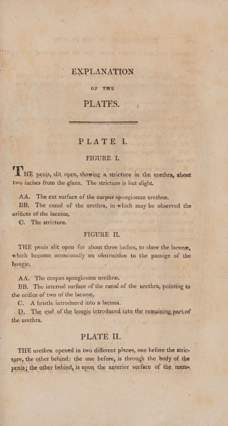 EXPLANATION OF r E PLATES. PLA TB 4. FIGURE L Vs penis, slit open, showing a stricture in the urethra, about two inches from the glans, The stricture is but slight. AA. The cut surface of the corpus spongiosum urethra, | BB. The canal of the urethra, in n which may be observed sige orifices of the lacuna, €. The stricture. © FIGURE Il. THE -penis slit open for about three iuches,.to shew the lacunz, which become occasionaily’an obstruction to the passage of the bougie. 2 : . i AA. The corpus. spongiosum urethrae. BB. The internal surface of the canal of the sepa pointing te the orifice of two of the lacune. C. A bristle introduced into a lacuna. D.. The end of the hougie introduced, into, the remaining, boriaot the urethra. PLATE IL. THE urethra opened in two different places, one before the stric-