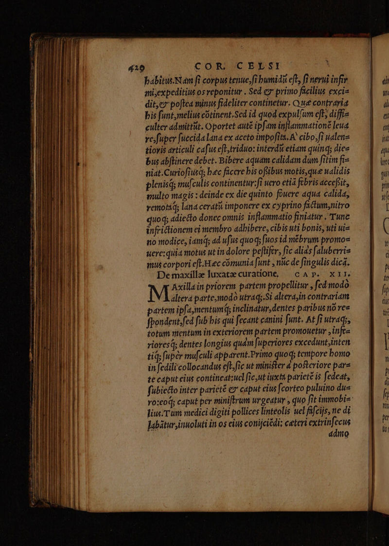 COR CEFLSI TUS UN babitus.Nam ft corpus tenue,fi bumidi eft; fi neyui infr qniyexpeditius os reponitur . Sed ez primo facilius exci dit,e? poftca minus fideliter continetur. O we contraria bis funt,melius cotinent,Scd id quod expulfum eft; diffi culter admittit. Oportet auté ipfam inflammatione leua ve;fuper fuecida lana ex aceto impofita. A. cibo.fi sialenz tiovis articuli cafus eft,triduo: interdu etiam quinq; diee bus ablinere debet. Bibere aquam calidam dum fitim fi- niat.Curiofitisq; bec faccre bis ofibus motis,que ualidis plenisq mufculis continentur:fi uero etia febris accefit, multo magis : deinde ex die quinto fowere aqua calida, vemotid; lana cerati imponere ex cyprino fatum;nitro quo d; adiecto donec omnis inflammatio finiatur Tunc infrictionem ei membro adhibere, cibis uti bonis, uti uie no modice, iamd; ad ufus quoq; fuos id mébrum promo- uere: quia motus ut in dolore peftifer, fic alias faluberris mus corpori eft.-Haec cómunia funt , nuc de fingulis dica. — Demaxille luxatzecuratione, cap. xir. M Axilla in priorem partem propellitur , fed modo L altera partemodo utraq;.Si alterajin contrariam partem ipfa,mentumq inclinatur, dentes paribus no e» fpondent.fed fub bis qui fecant canini. funt. At fi utraqs, totum mentum in exteriorem partem promouetur jinfce riores; dentes longius qudm [uperioves excedunt;inten tiq, fuper mufculi apparent.Primo quoq; tompore bono in fedilicollocandus eft.fic ut minister 4 postcriore pare te caput eius contineatzucl ficut iuxta pariete is fedeat, fübie&o inter paricté ex caput cius fcorteo puluino dus yo:eoq; caput per miniftrum urgeatur , quo fit immobi-: JliusT um medici digiti pollices linteolis uel fafcijs, ne di labáturyinuoluti in os ciu conijcicdi; ceteri extrinfccus ddno